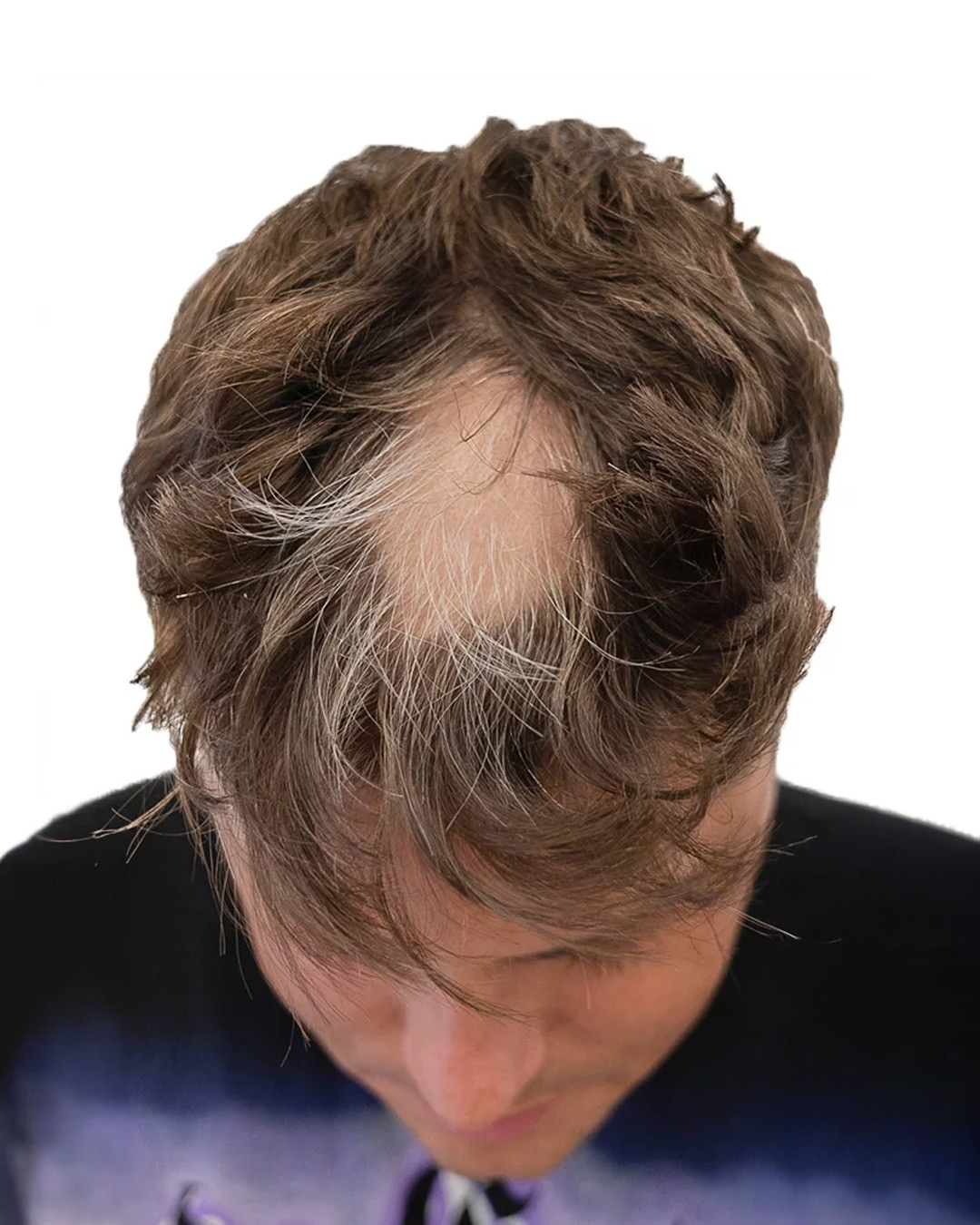 Oliver före hårbehandlingen