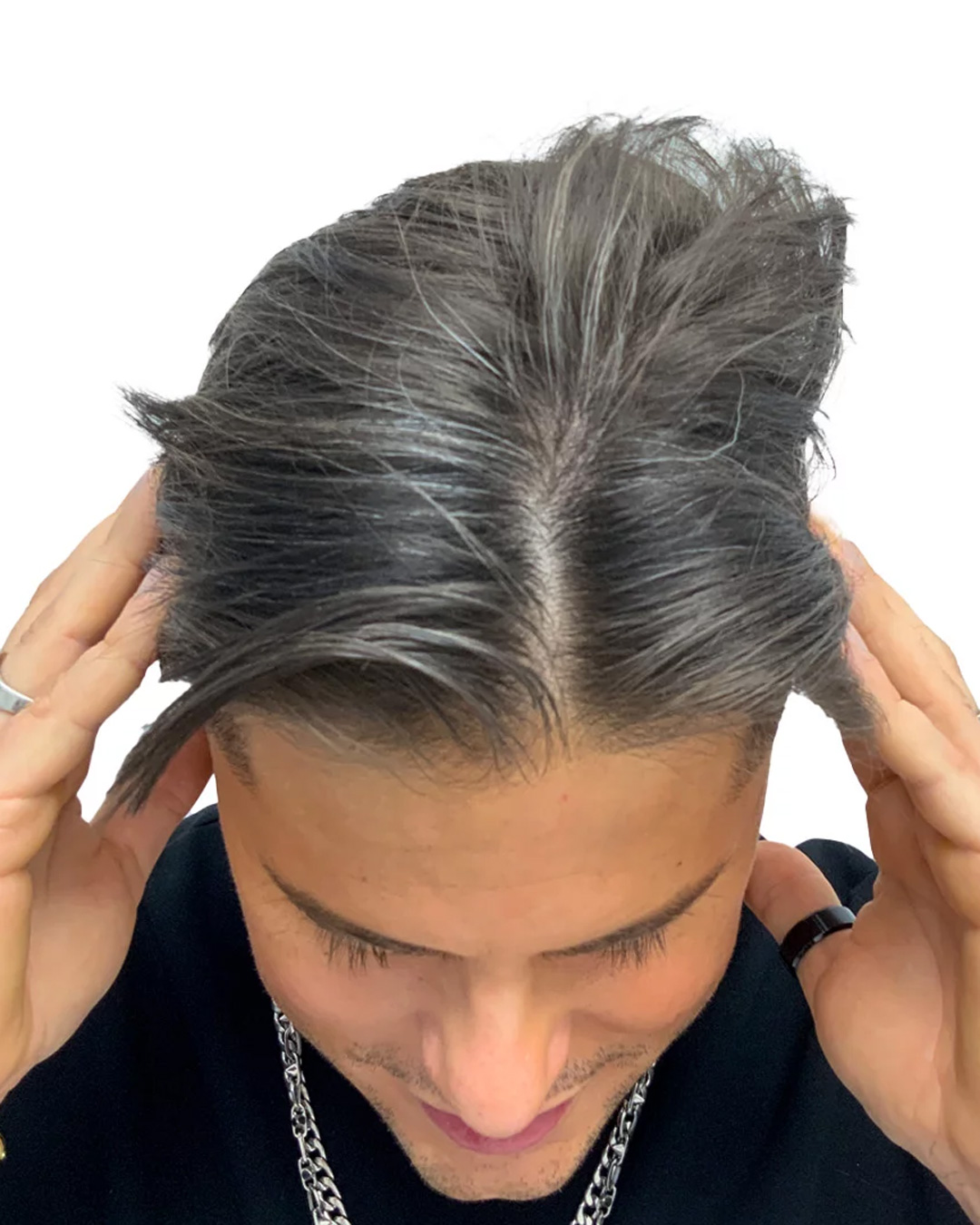 Oliver efter hårbehandlingen