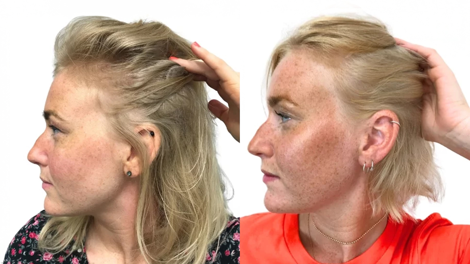 Jonna – före och efter sin hårbehandling