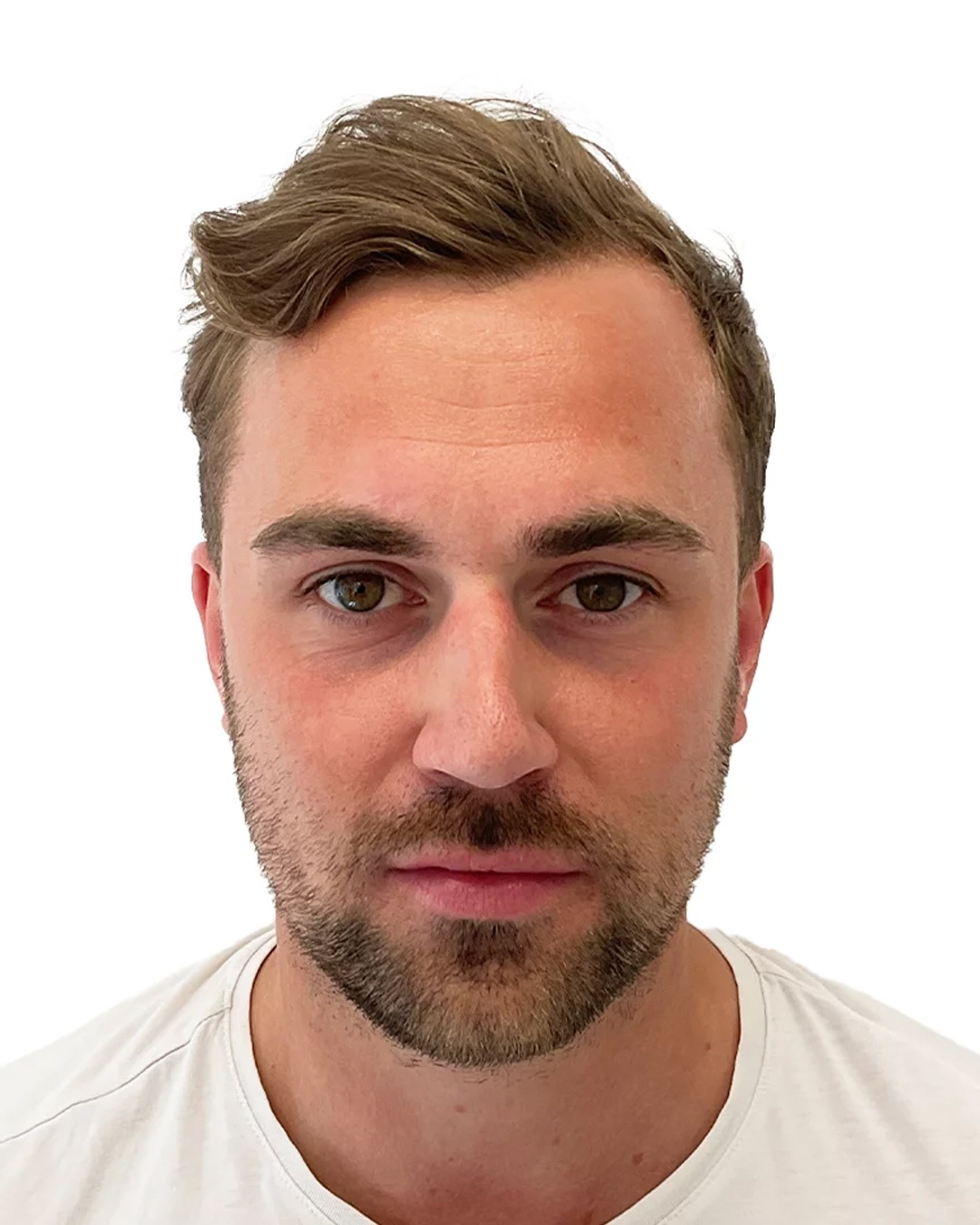 Joakim efter hårbehandlingen