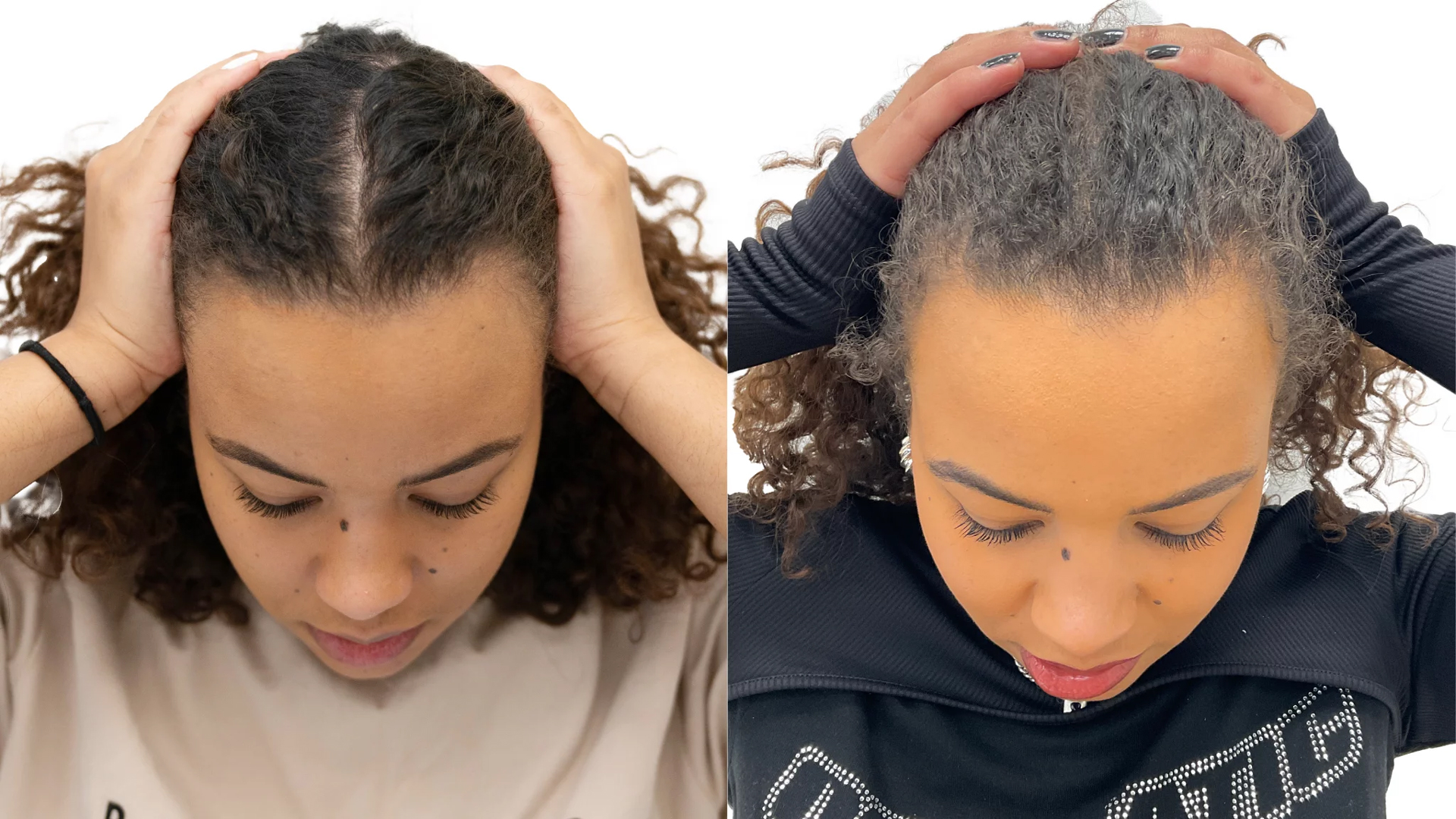 Adjani – före och efter sin hårbehandling