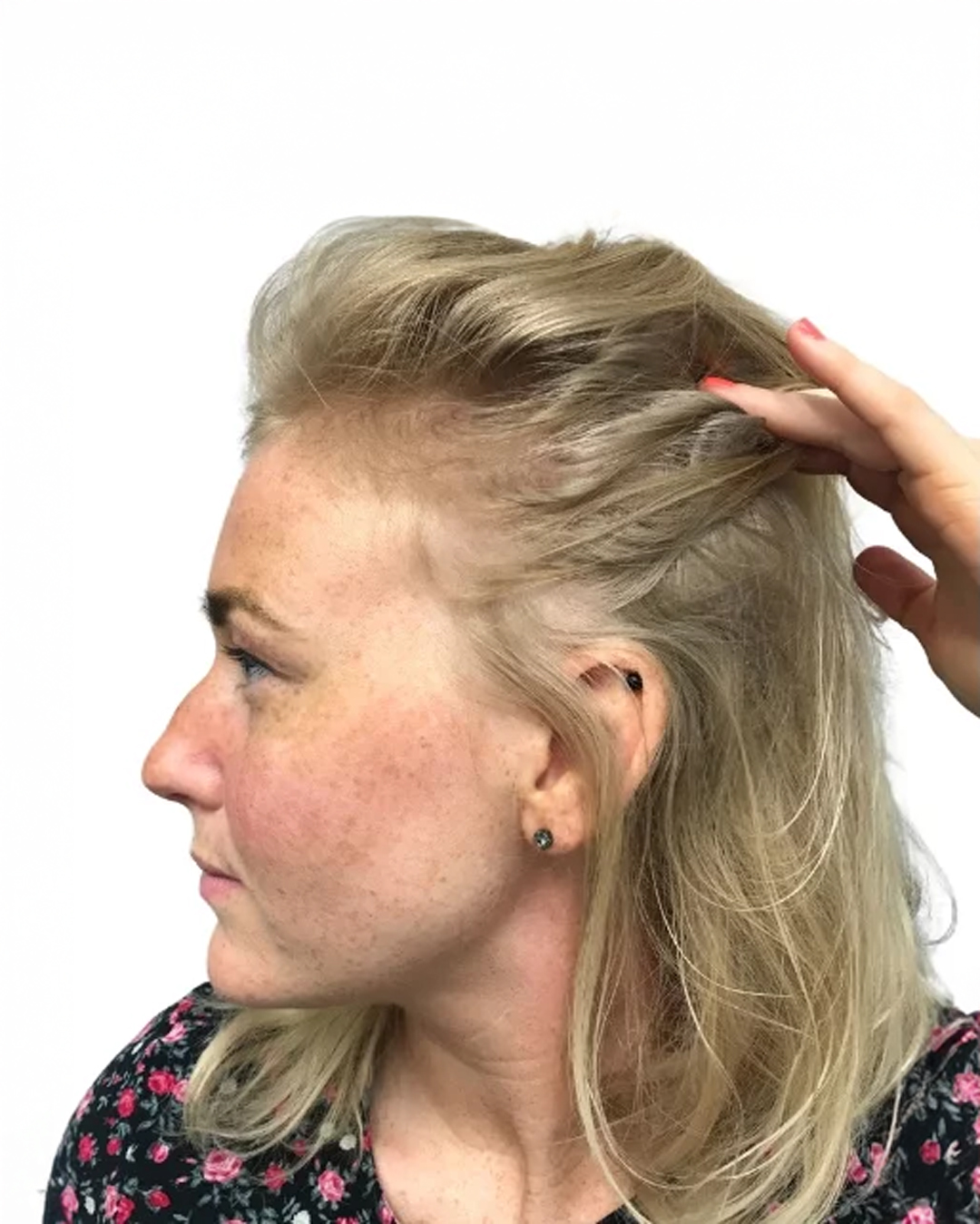 Jonna før hårbehandlingen