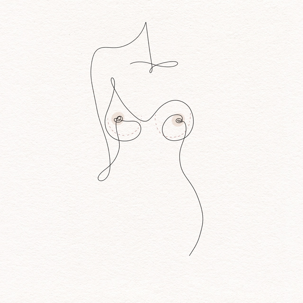 Breast Revision