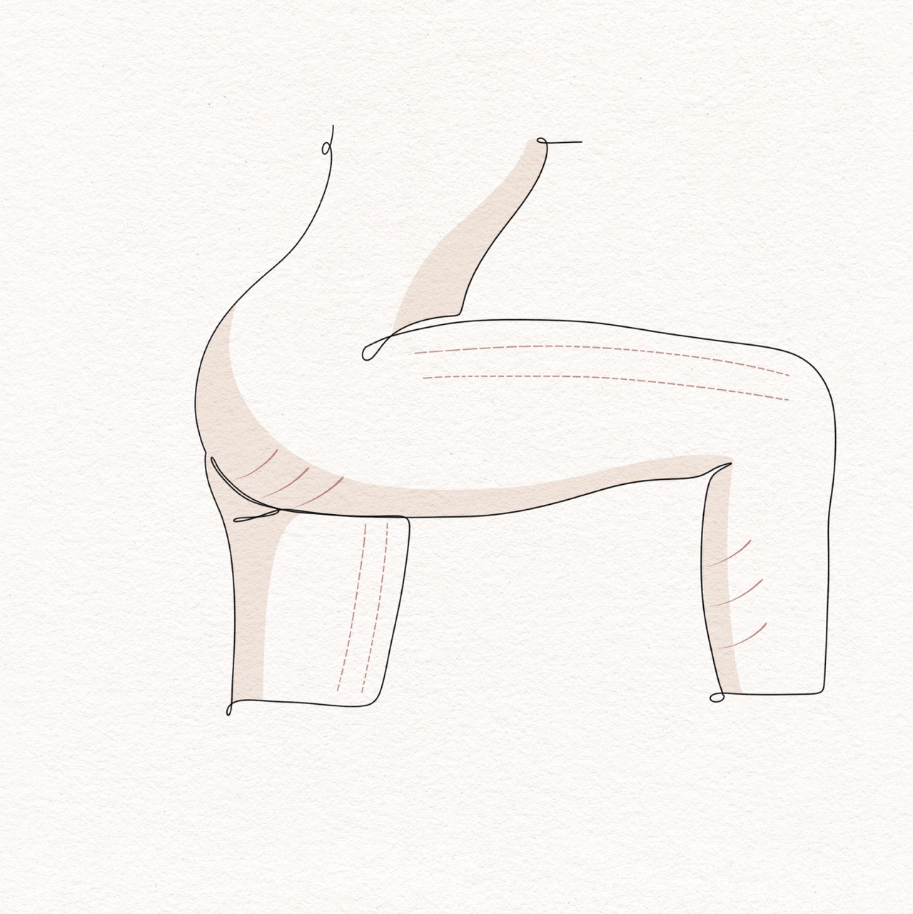Thigh Lift