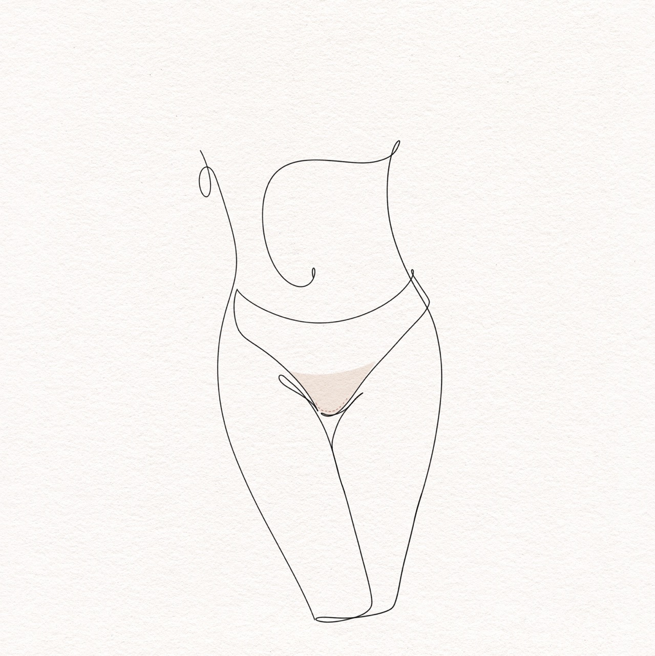 Labiaplasty