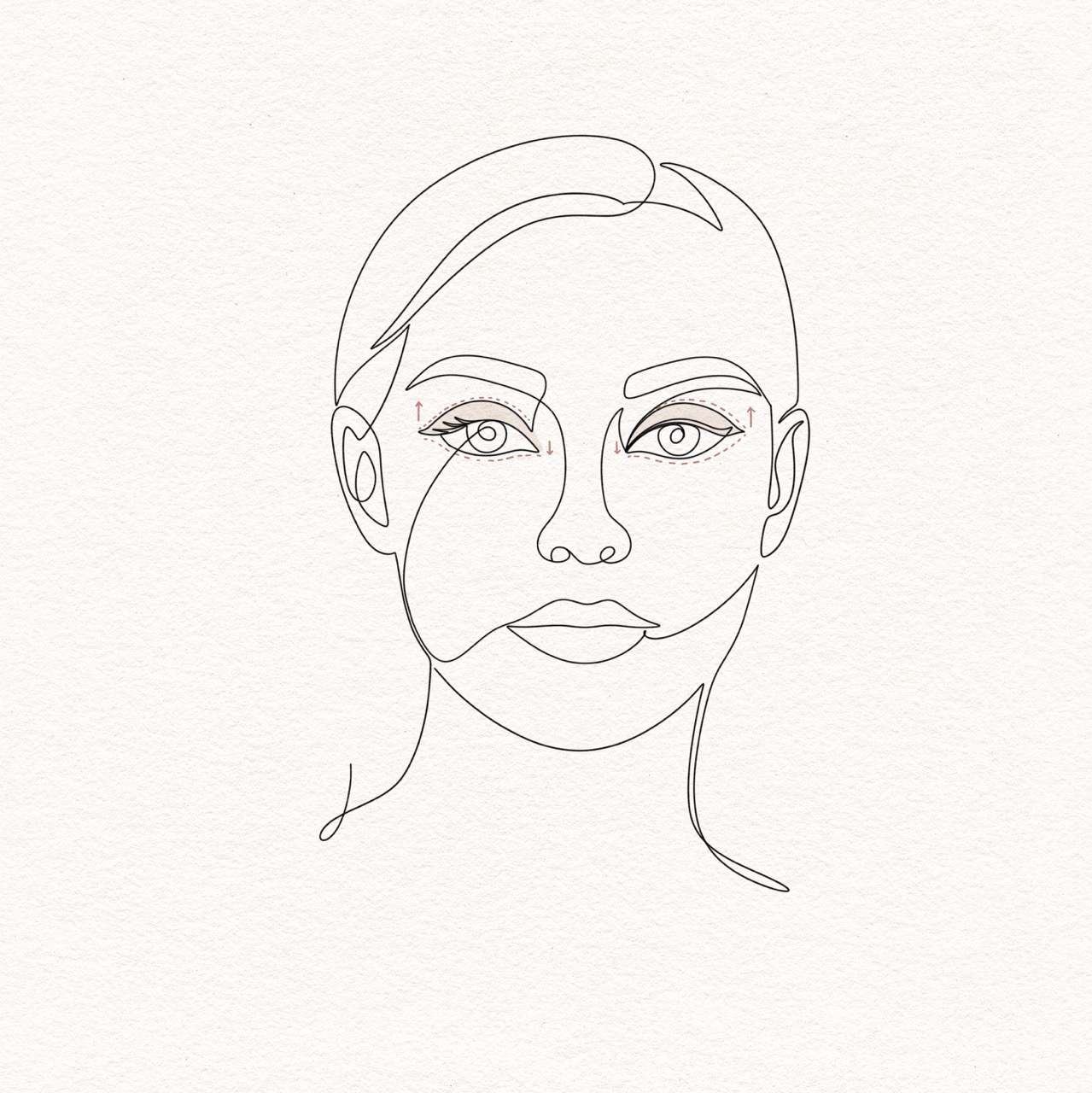 Eyelid Surgery