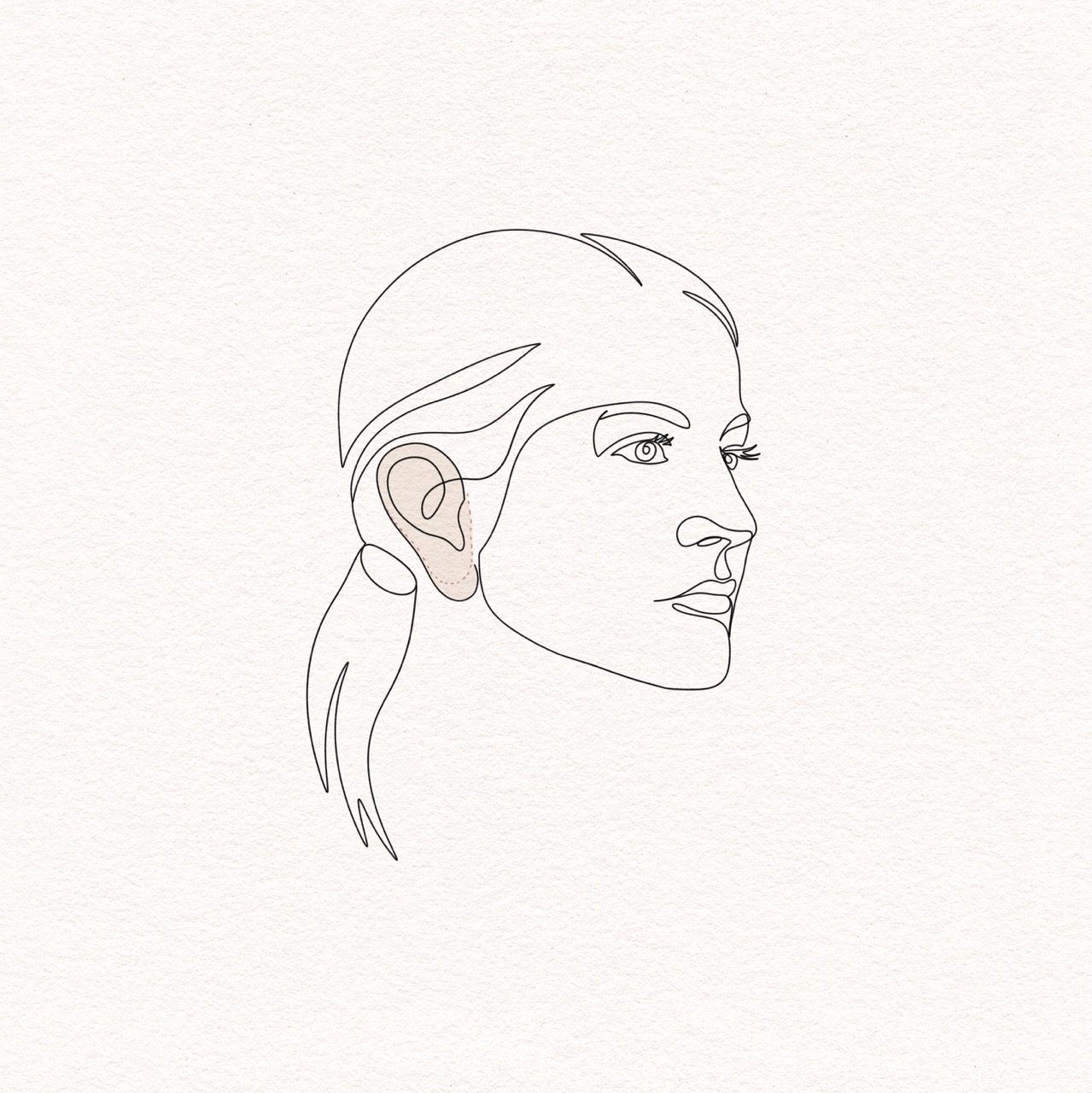 Earlobe Rejuvenation
