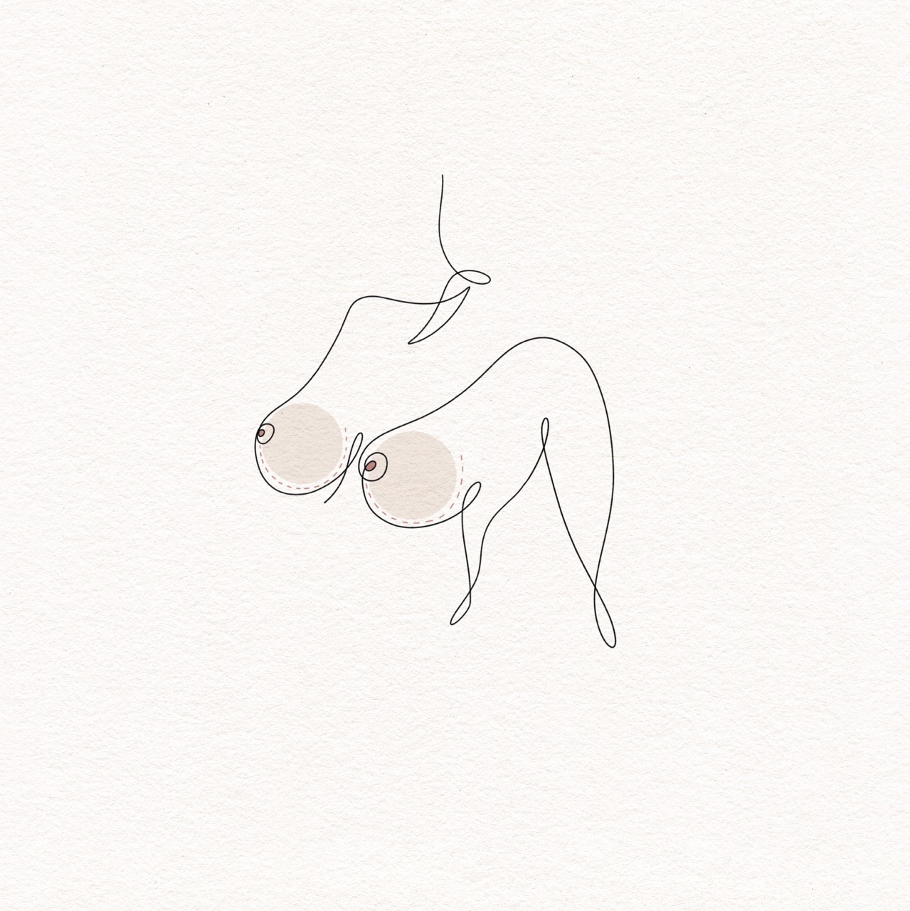 Breast Augmentation
