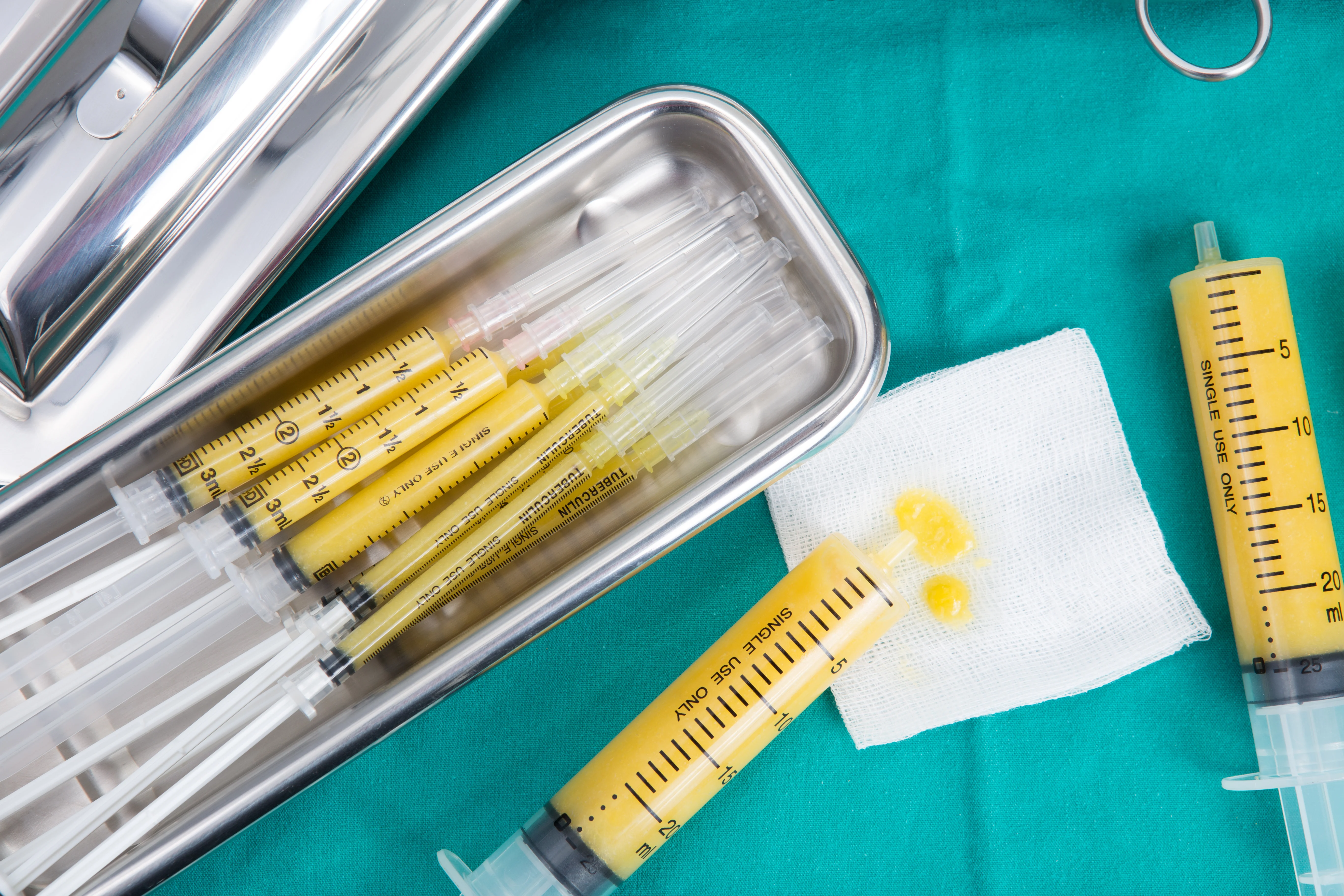 How Your Own Fat Can Improve Your Face, Breasts, Butt, Hands, and More