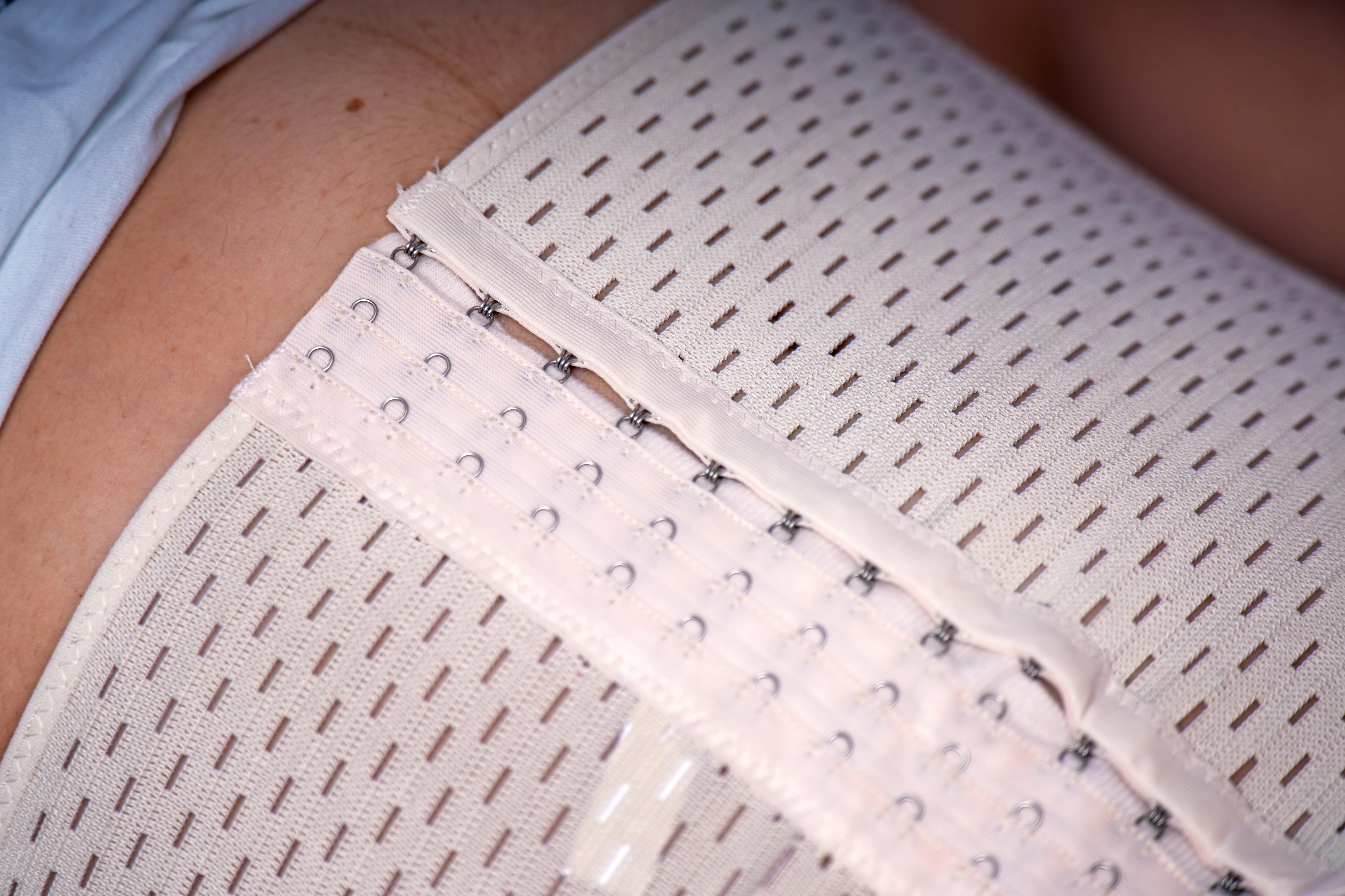 Do You Really Need to Wear a Post-Op Abdominal Binder or Compression Garment?