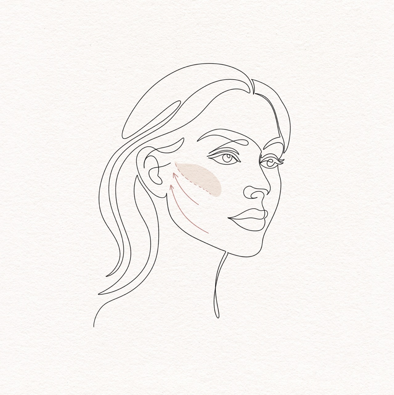 Face Lift & Neck Lift