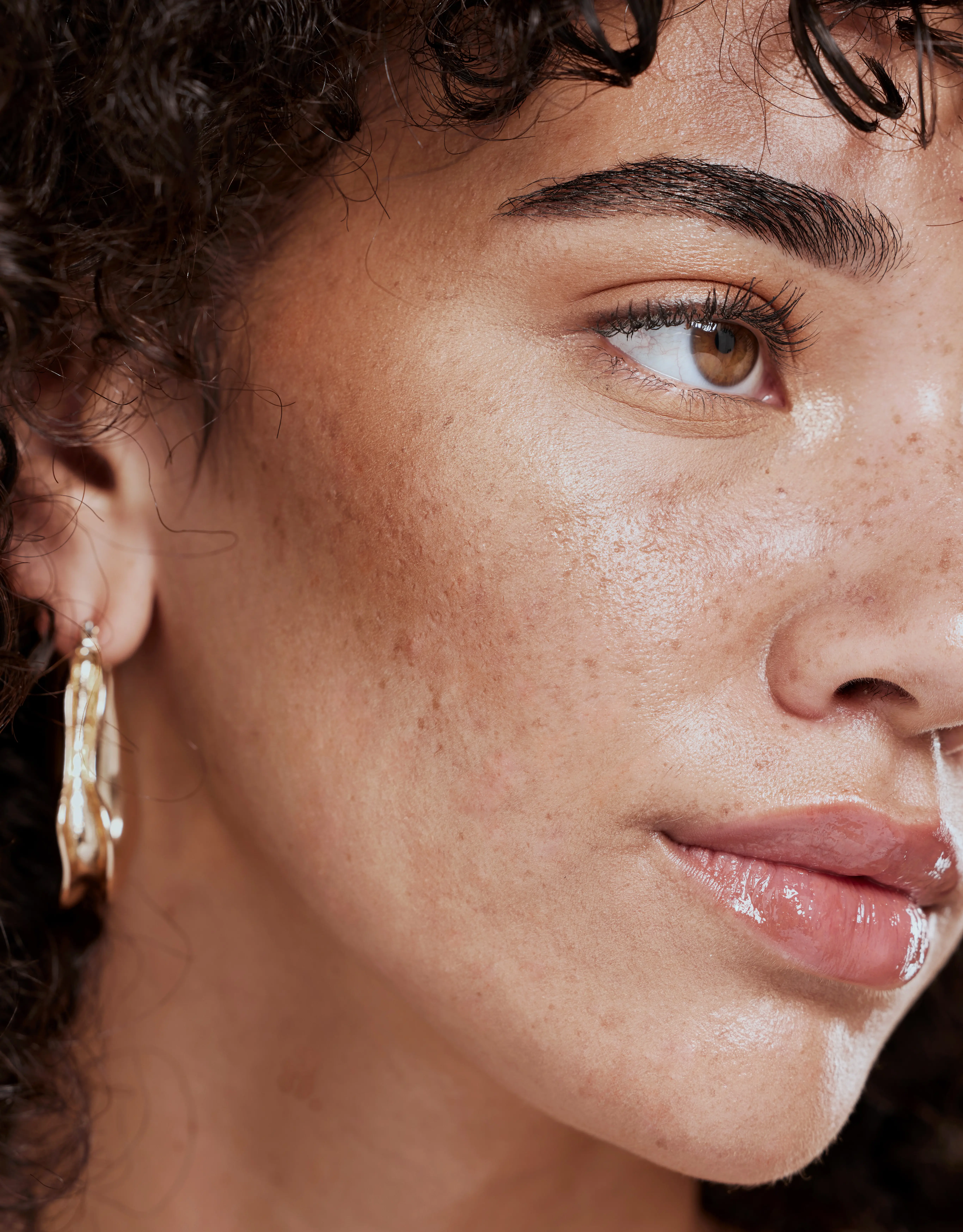 Close-up of woman’s face with smooth, radiant skin and softened fine lines after neurotoxin treatment