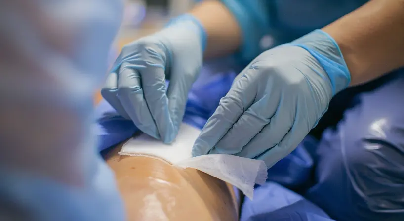 An image of applying dressings on the leg wound.