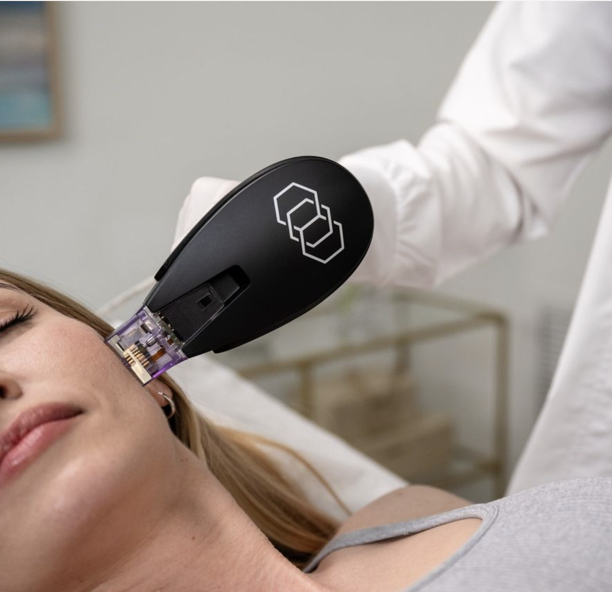 Facial Rejuvenation with Morpheus8