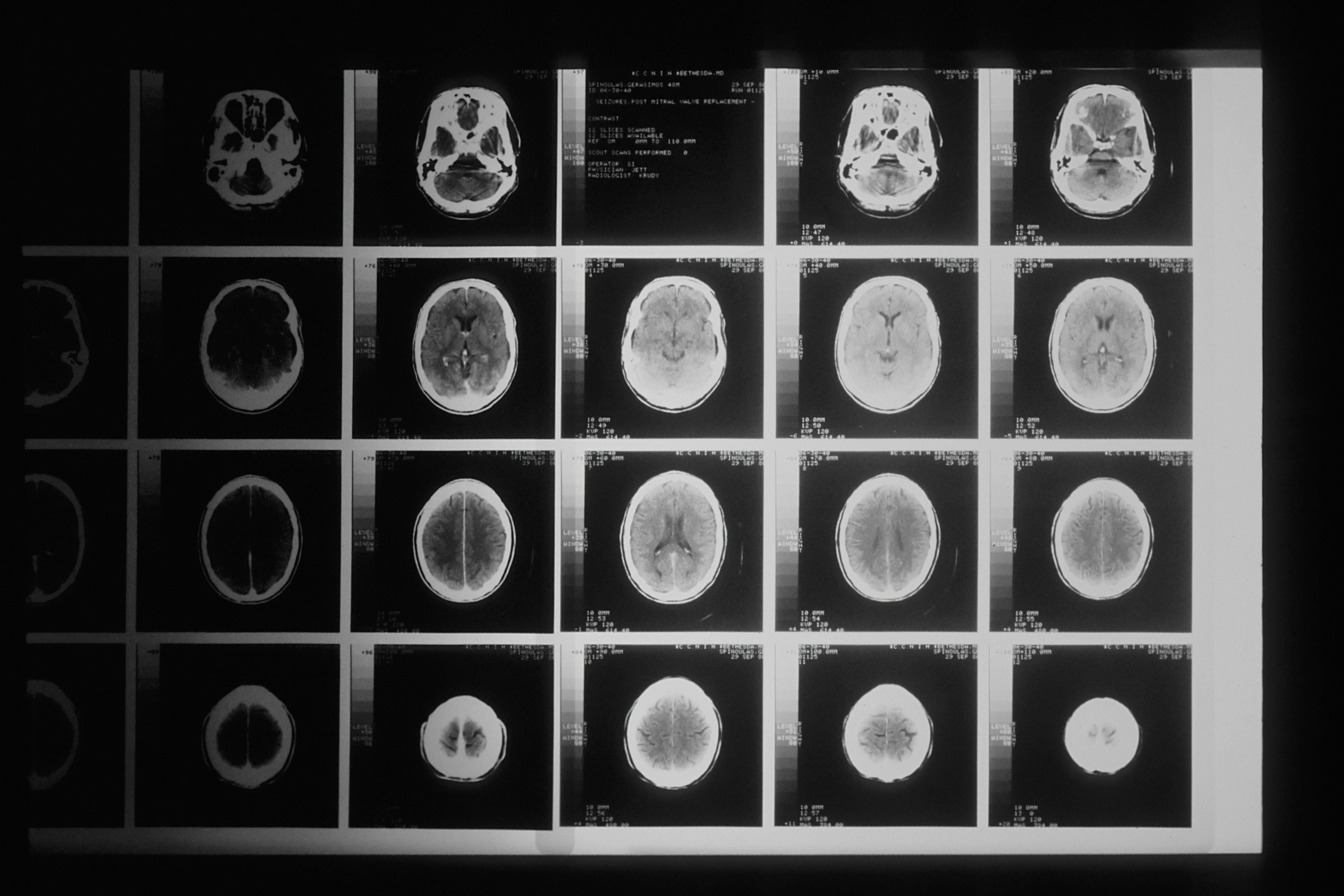 From Medical Imaging Data to IEEE Acceptance: Dhiren’s Research Journey