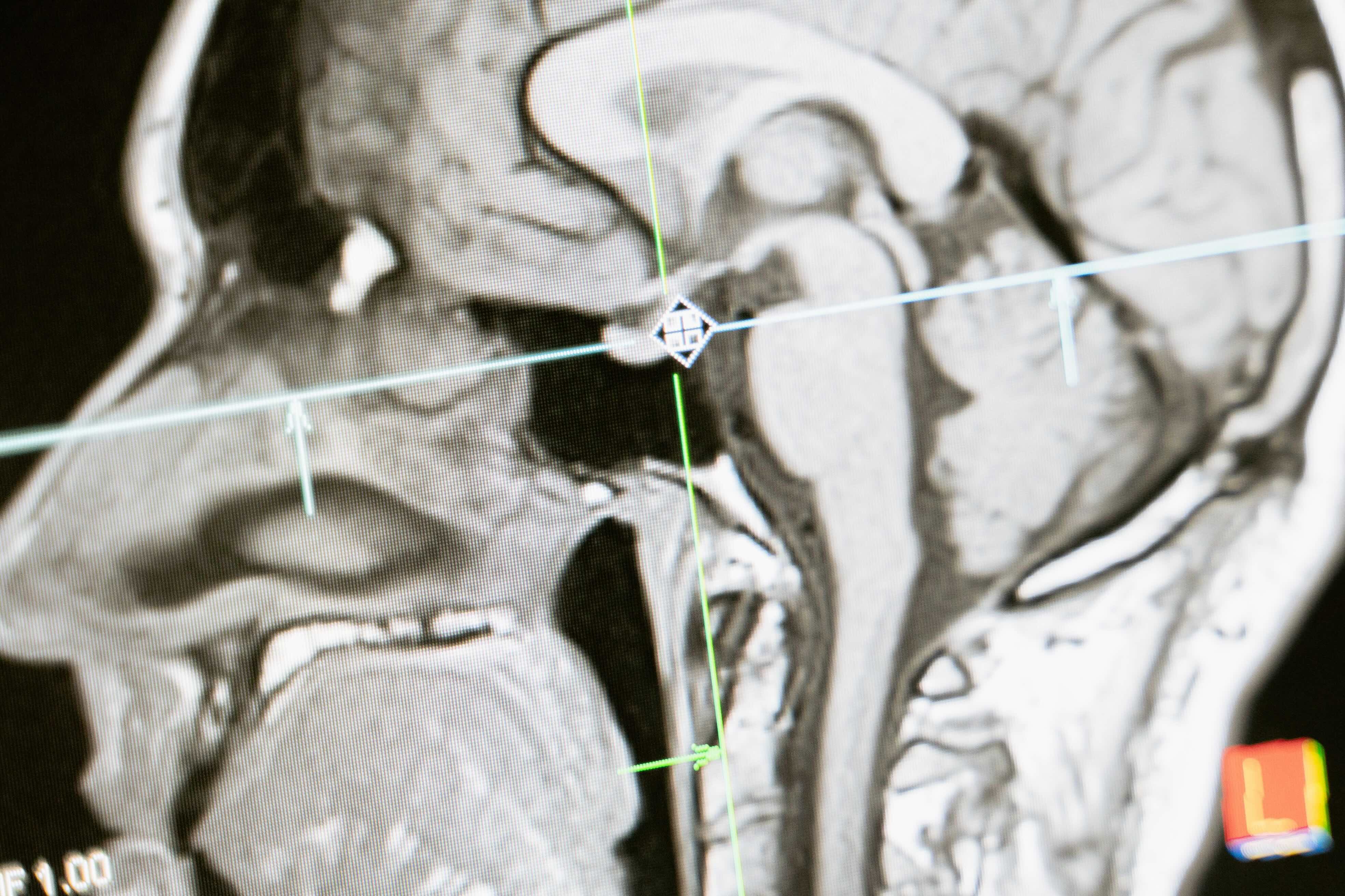 Medical Research Topics for High School Students: 9 Ideas