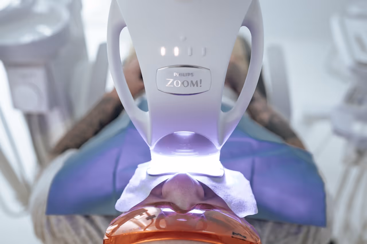 Teeth whitening treatment at Maida Smiles dental clinic, Maida Vale, London