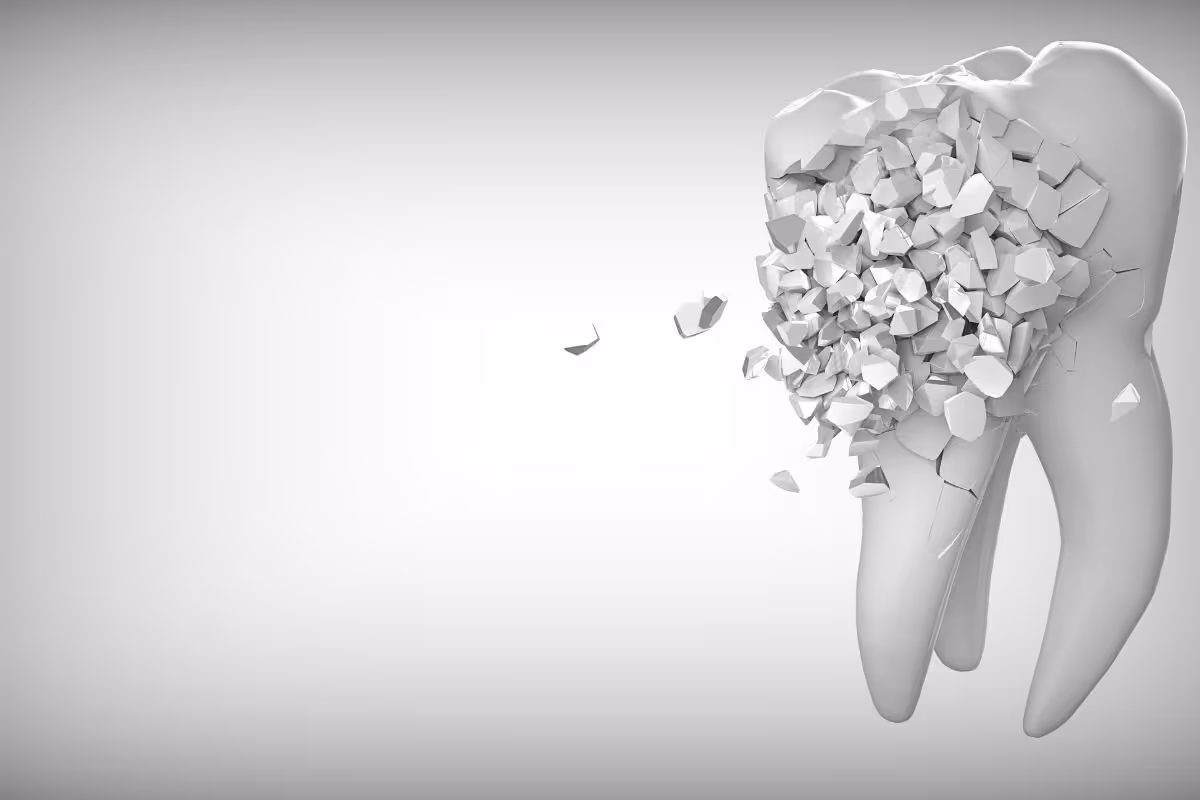 image of broken tooth
