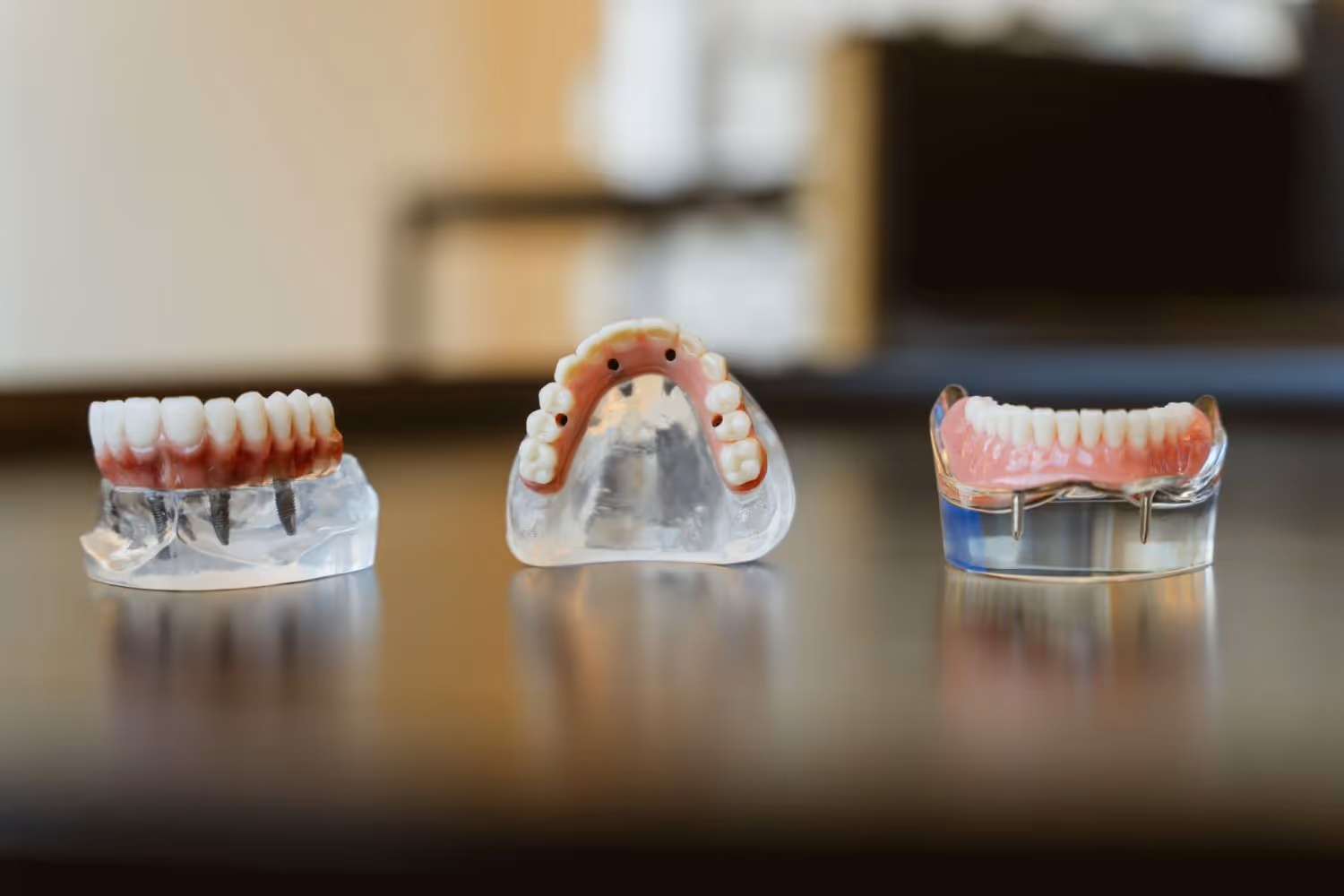 full mouth implant prostheses image