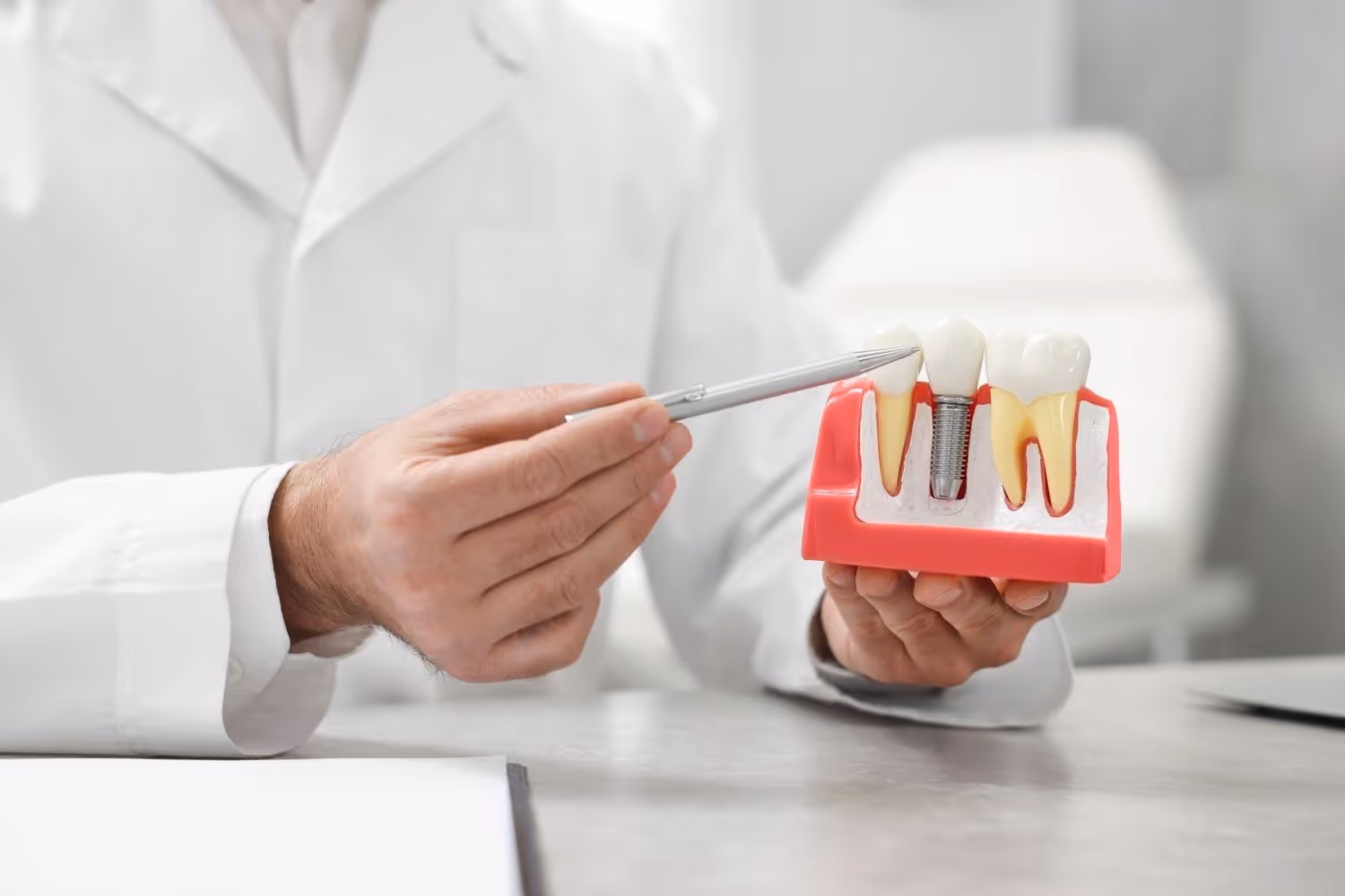 dental implant explanation