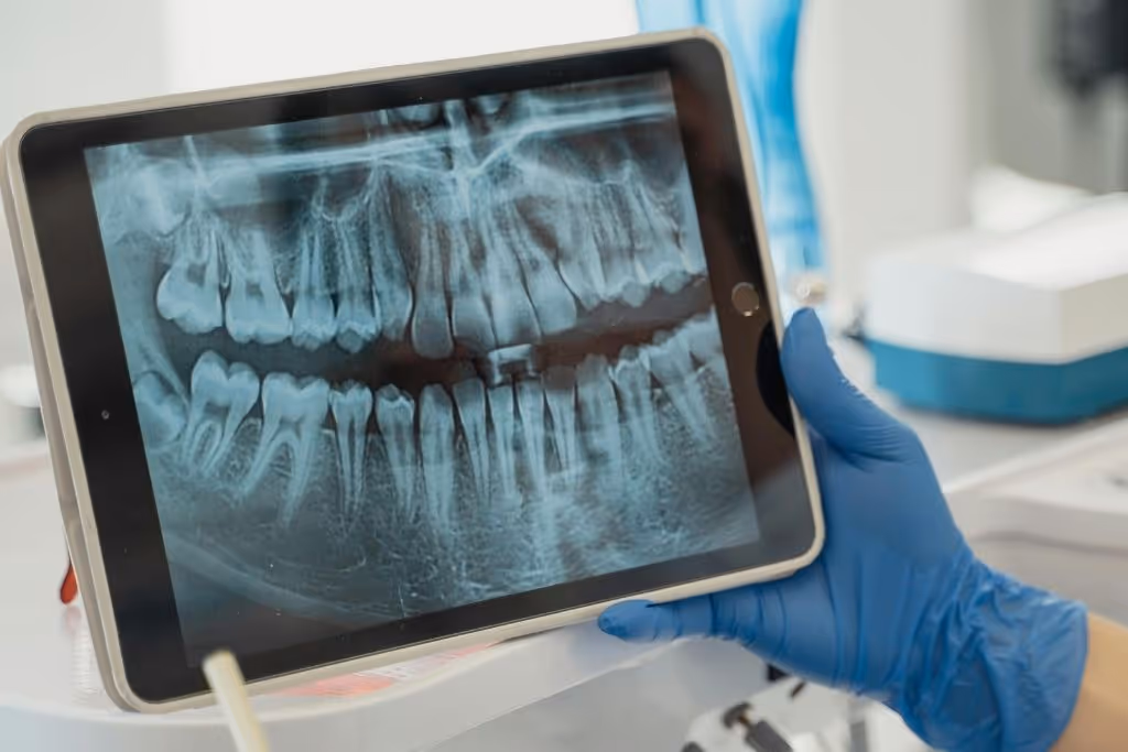 dental implant technology