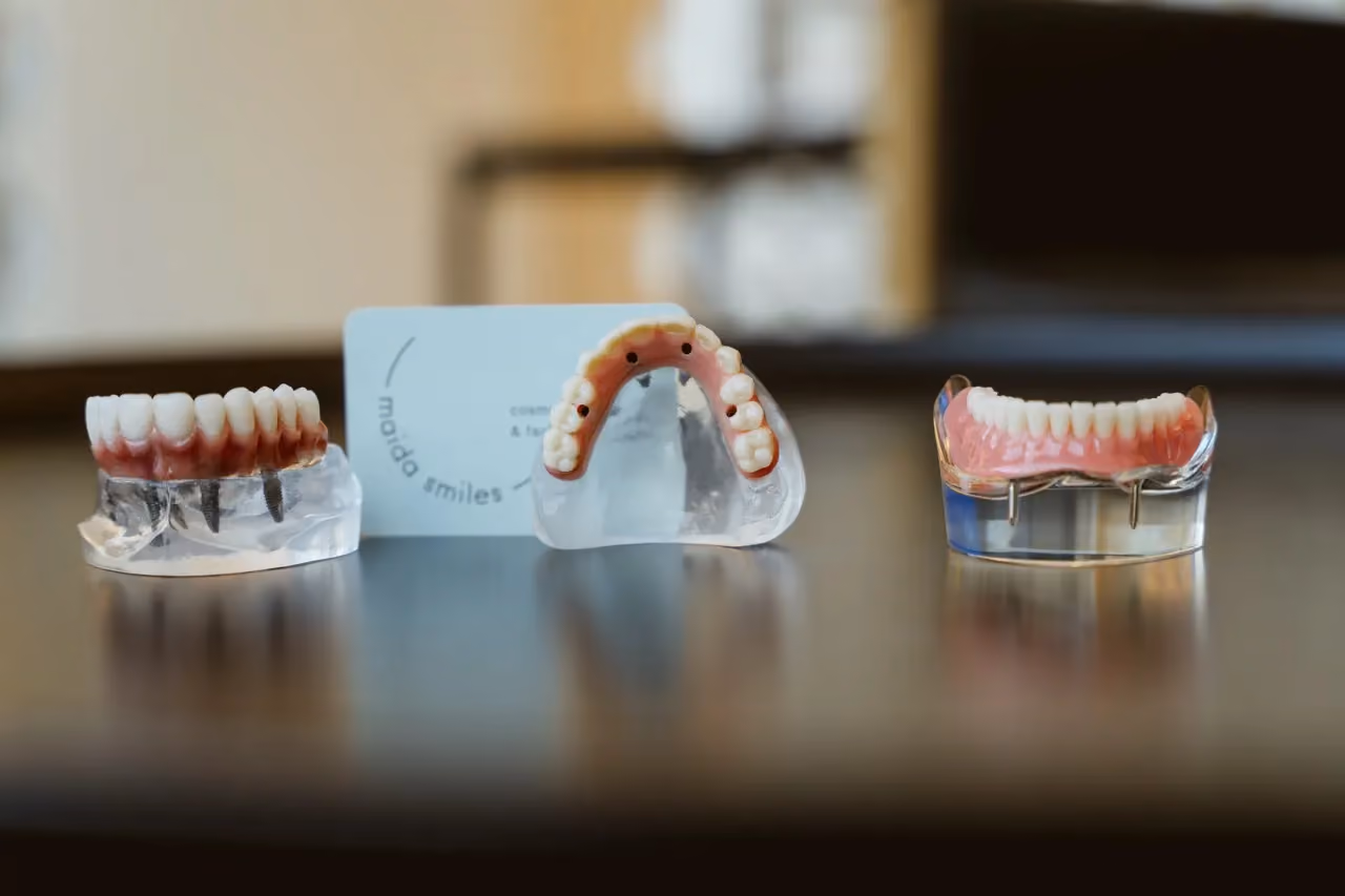 Zirconia ceramic crowns at Maida Smiles, Maida Vale