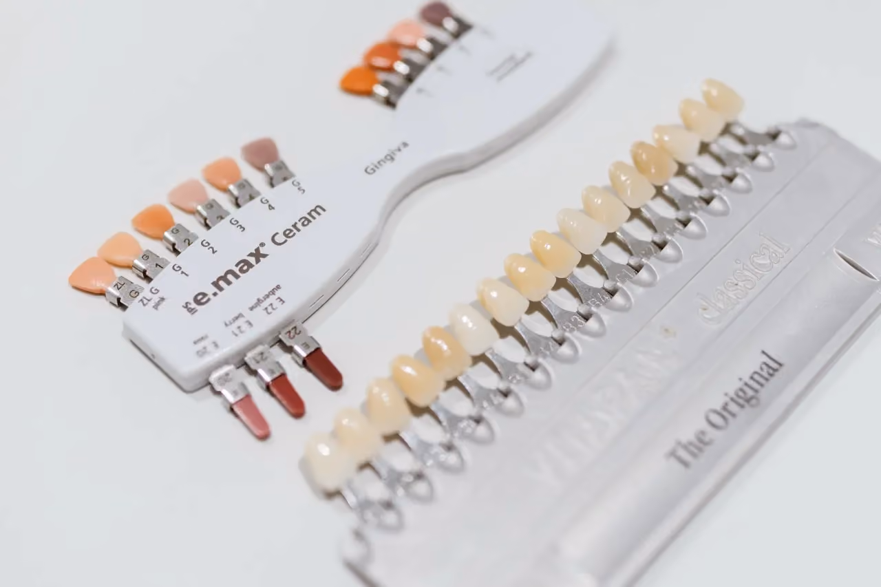 Dentures at Maida Smiles dental clinic, Maida Vale