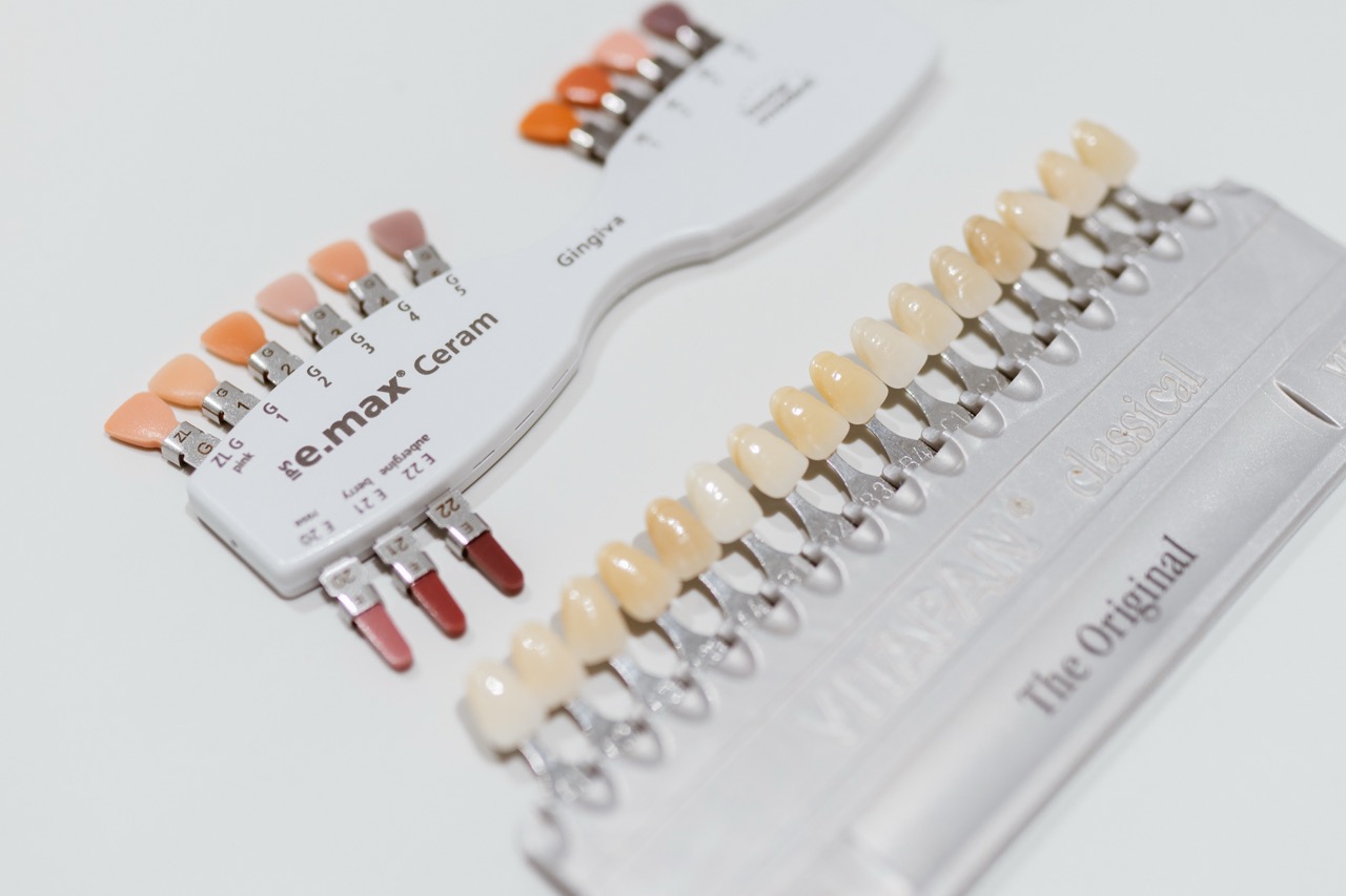 Dental implant treatment slide at Maida Smiles dental clinic, Maida Vale, London