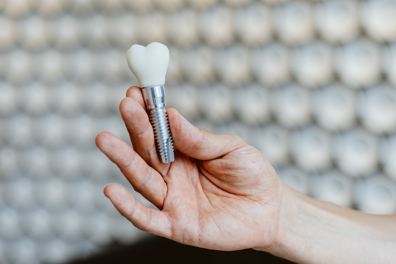 Dental implant treatment slide at Maida Smiles dental clinic, Maida Vale, London