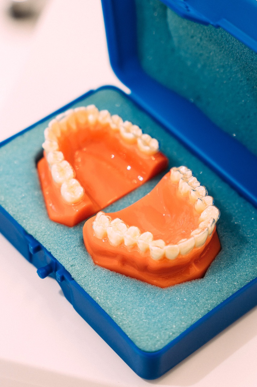 Dental implant treatment slide at Maida Smiles dental clinic, Maida Vale, London
