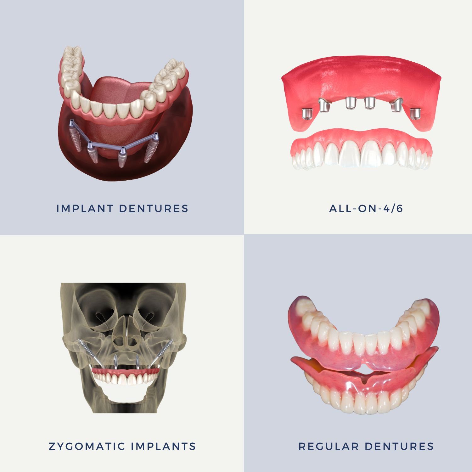 full mouth missing teeth options