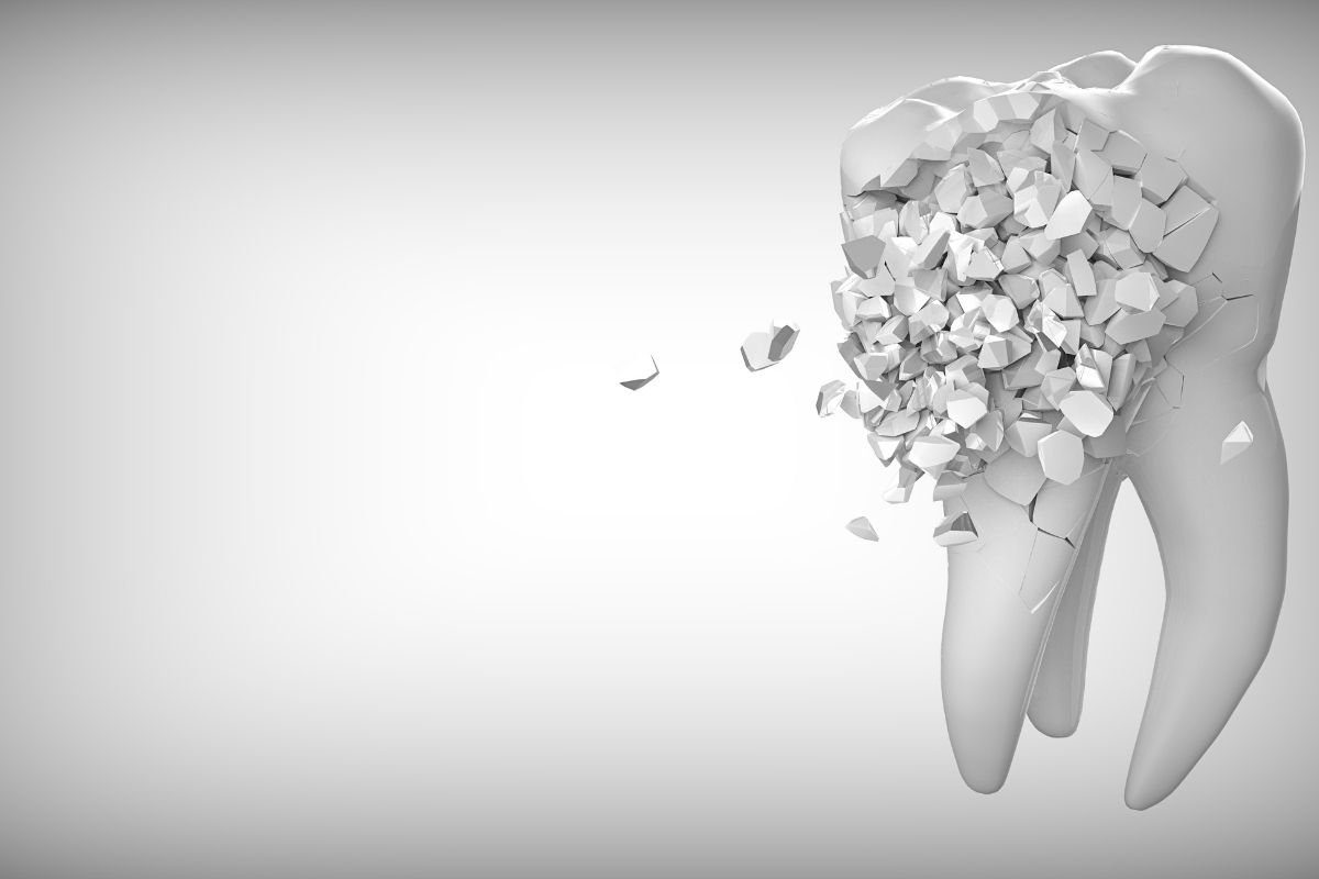 image of broken tooth