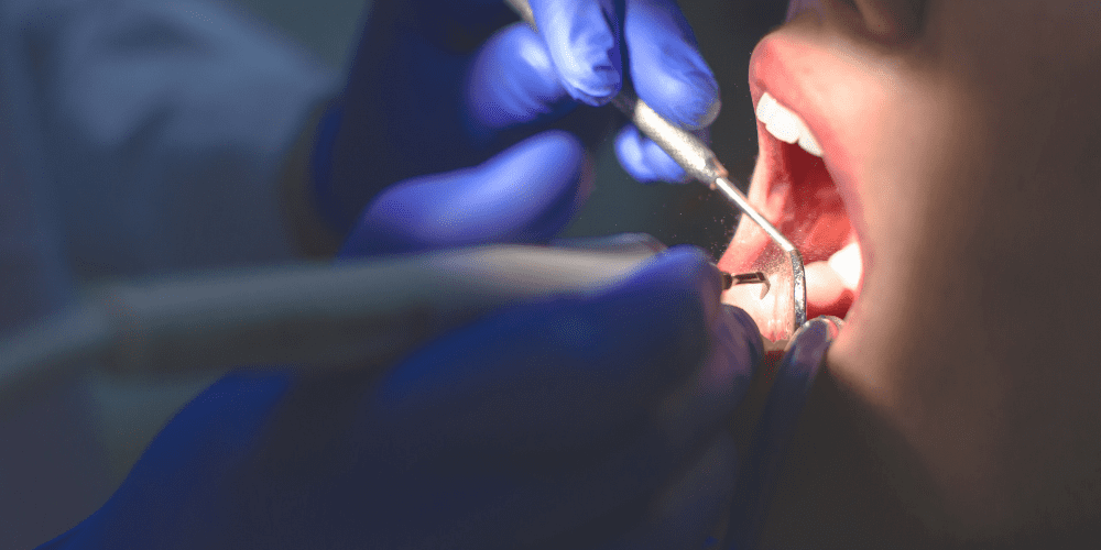 how often should you visit the dentist