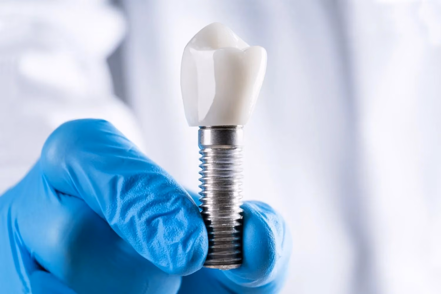 La verdad sobre los implantes dentales sin tornillo: lo que los pacientes deben saber