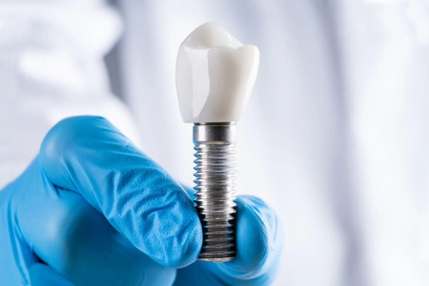 The Truth About Screwless Dental Implants – What UK Patients Should Know
