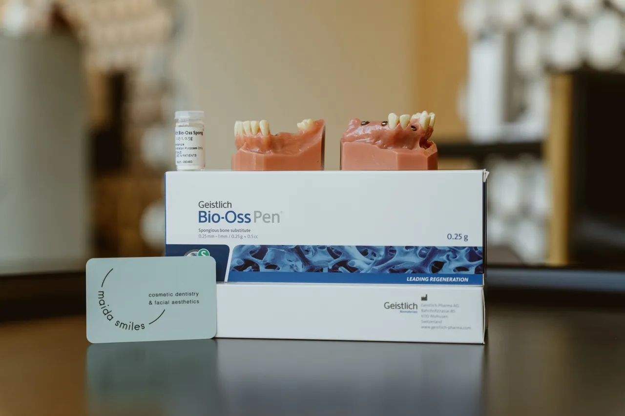 Dental implant treatment slide at Maida Smiles dental clinic, Maida Vale, London