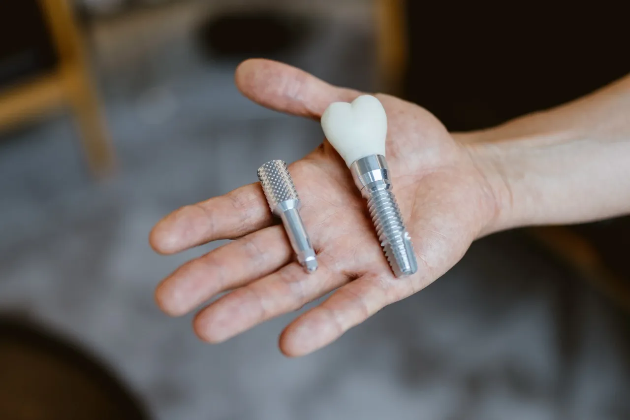 Dental implant treatment slide at Maida Smiles dental clinic, Maida Vale, London
