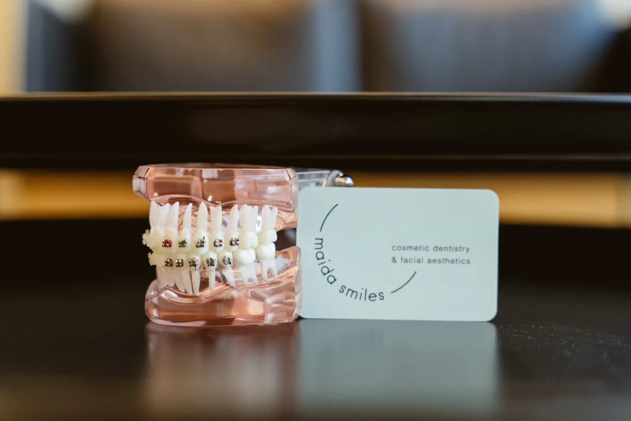 Cover image for the blog post "Dental implants vs Removable dentures" — Maida Smiles dental clinic, Maida Vale, London