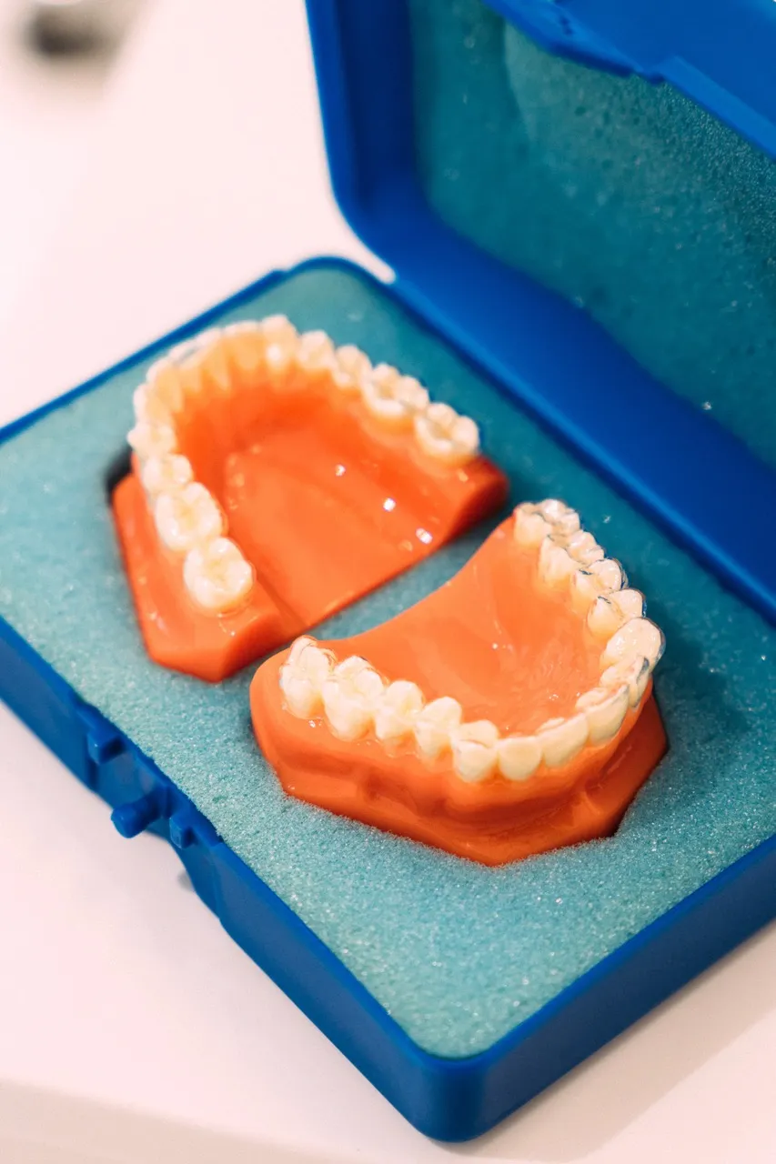 Cover image for the blog post "Immediate vs Delayed Implant Placement" — Maida Smiles dental clinic, Maida Vale, London