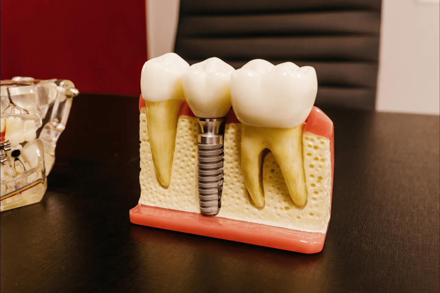 Cover image for the blog post "Turkey Teeth Gone Wrong – Are Cheap Implants Worth It?" — Maida Smiles dental clinic, Maida Vale, London