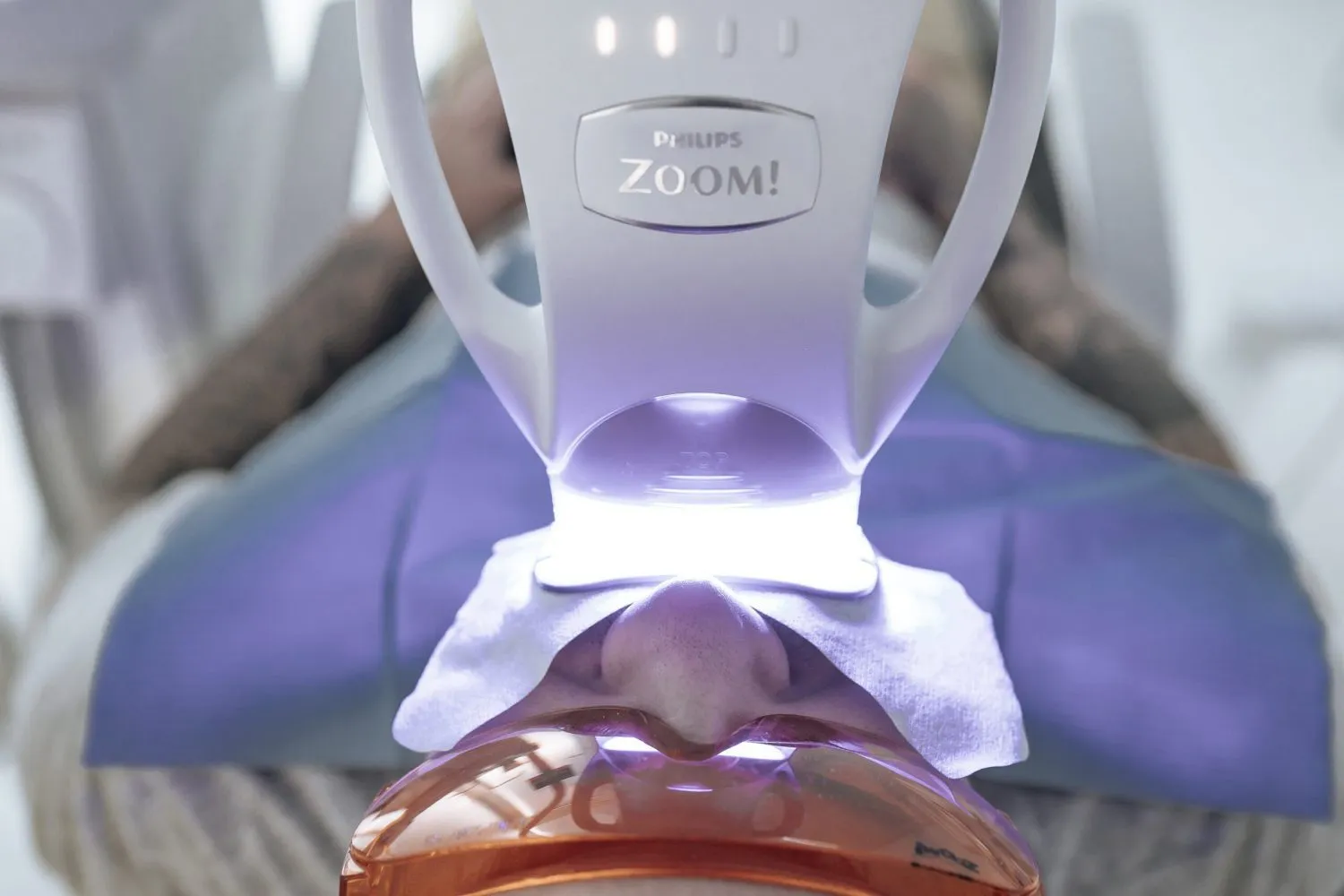Cover image for the blog post "Tips for Teeth Whitening" — Maida Smiles dental clinic, Maida Vale, London
