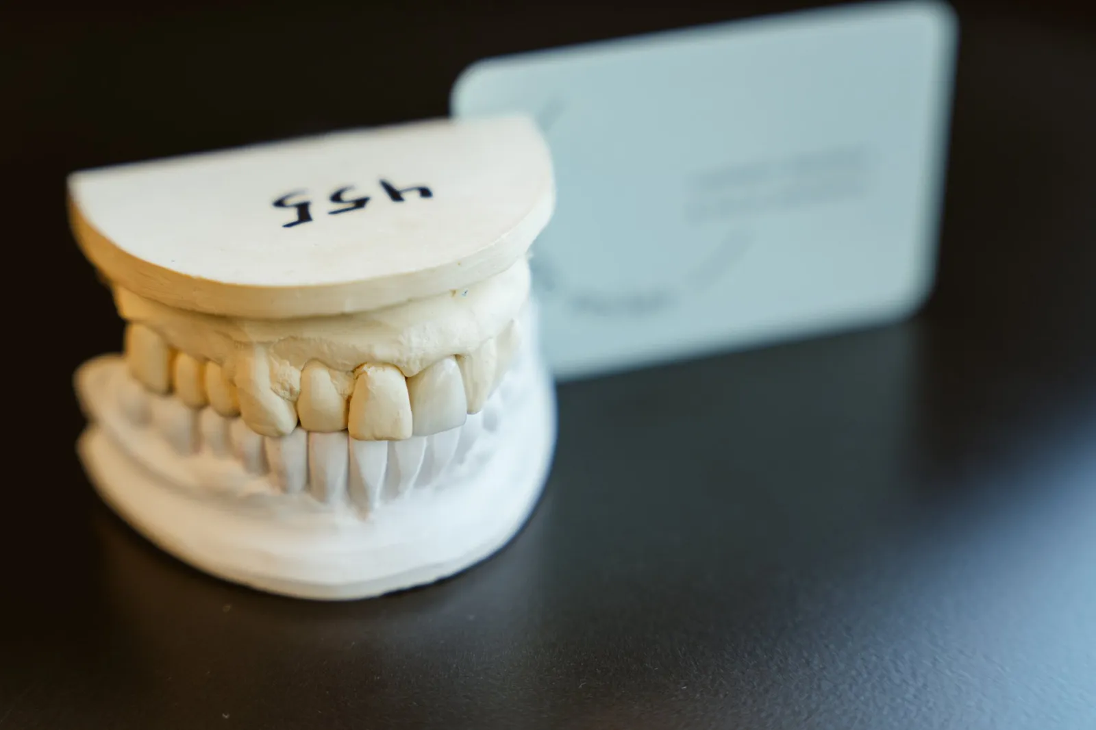 Plaster dental model with handwritten label beside a blurred clinic card.
