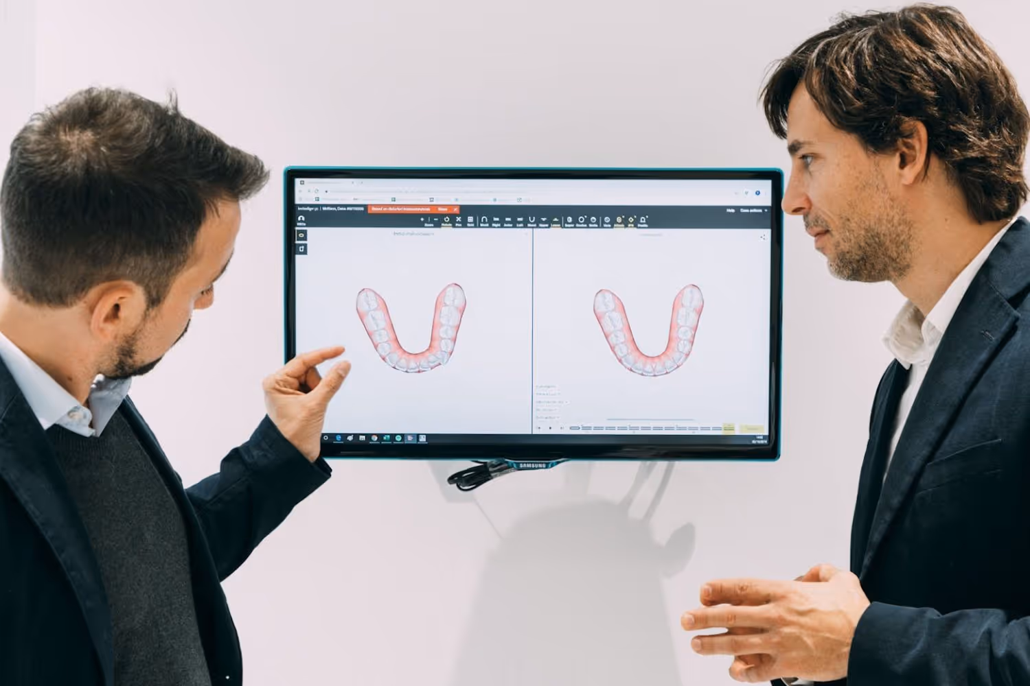 Imagem de capa do artigo «Aparelhos Metálicos vs Invisalign 2023» — clínica dentária Maida Smiles, Maida Vale, Londres