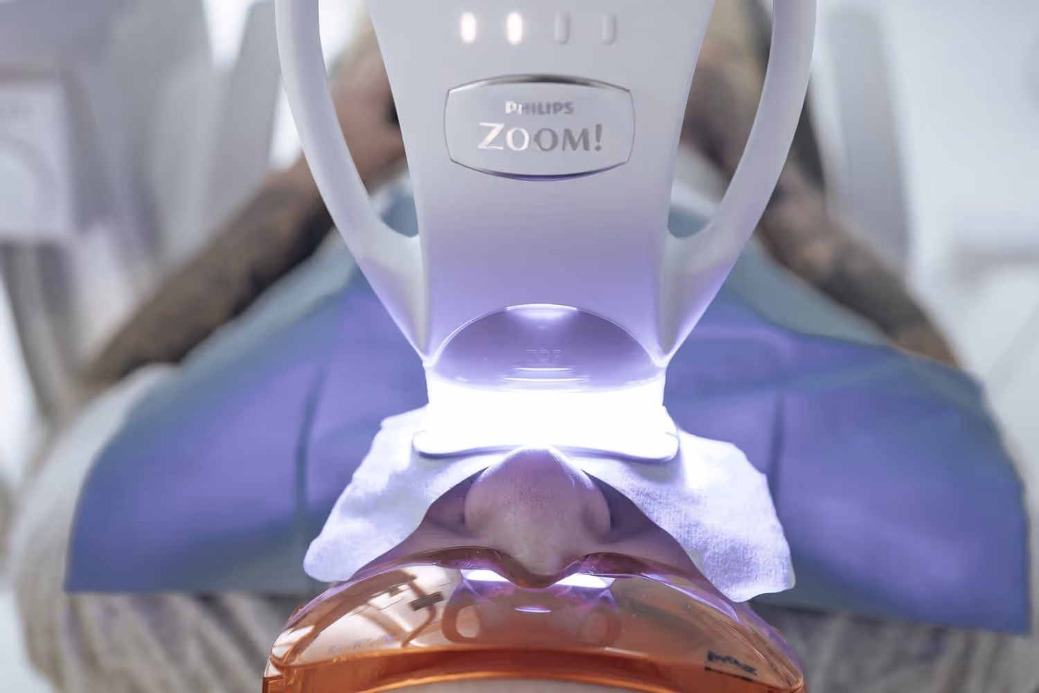 Imagem de capa do artigo «Dicas para branquear os dentes» — clínica dentária Maida Smiles, Maida Vale, Londres