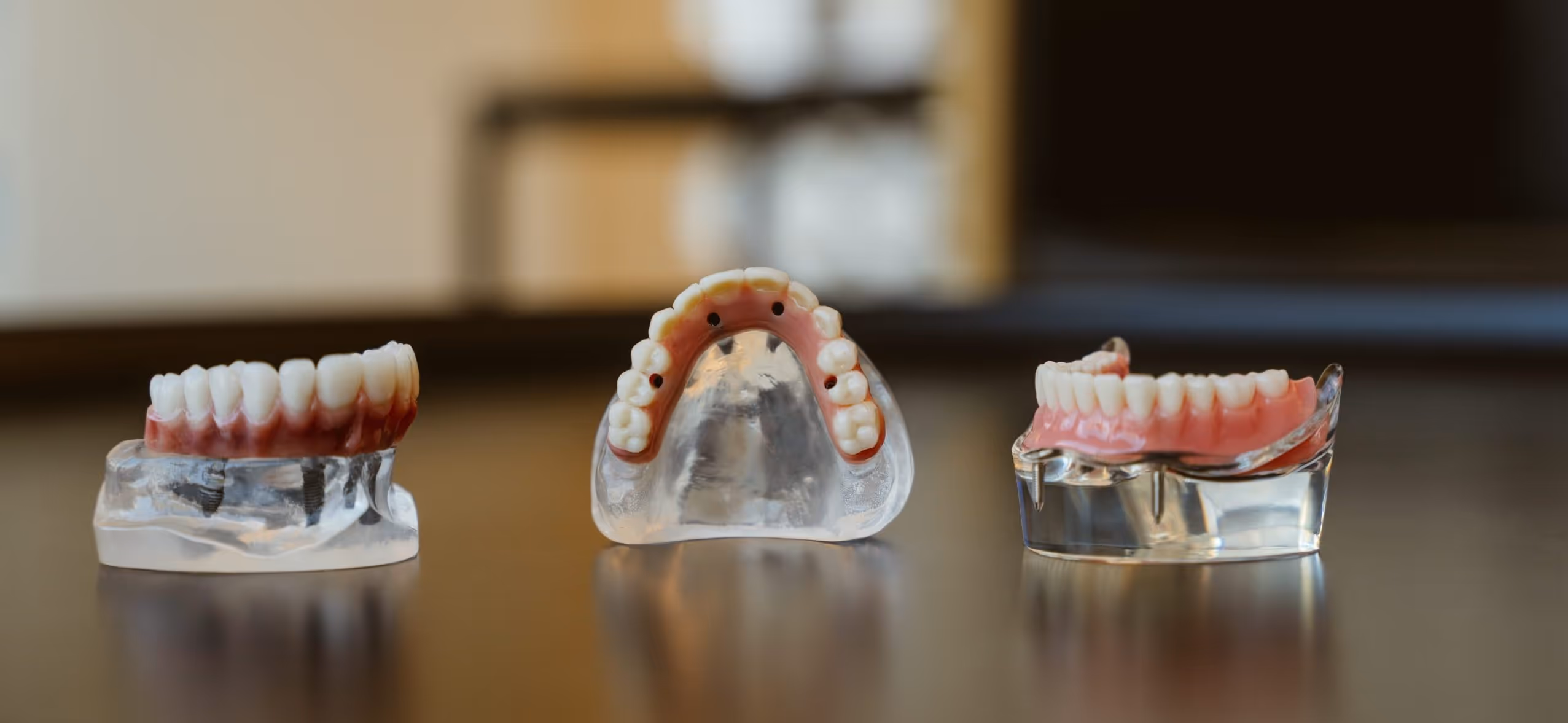 Imagem de capa do artigo «Próteses Removíveis (Snap-In): Benefícios, Desvantagens, Custos e Cuidados» — clínica dentária Maida Smiles, Maida Vale, Londres