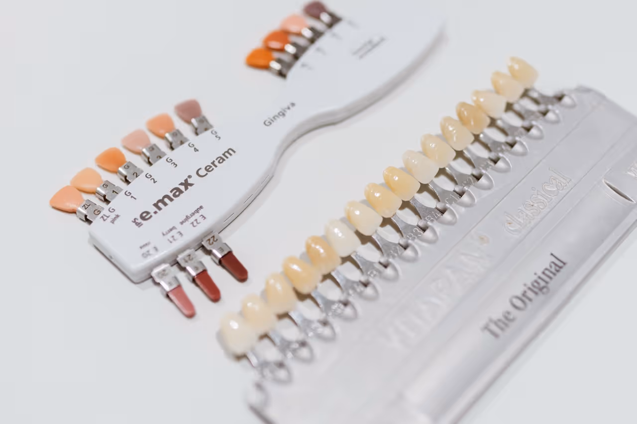 Prótesis dentales: tratamiento en Maida Smiles, clínica dental en Maida Vale