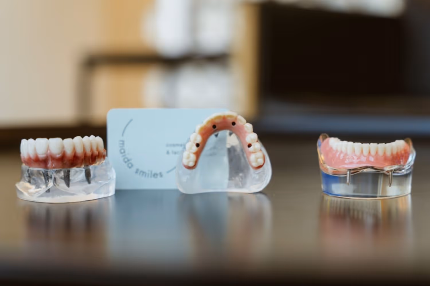 Imagem de capa do artigo «6 Coisas a saber antes de colocar implantes dentários» — clínica dentária Maida Smiles, Maida Vale, Londres