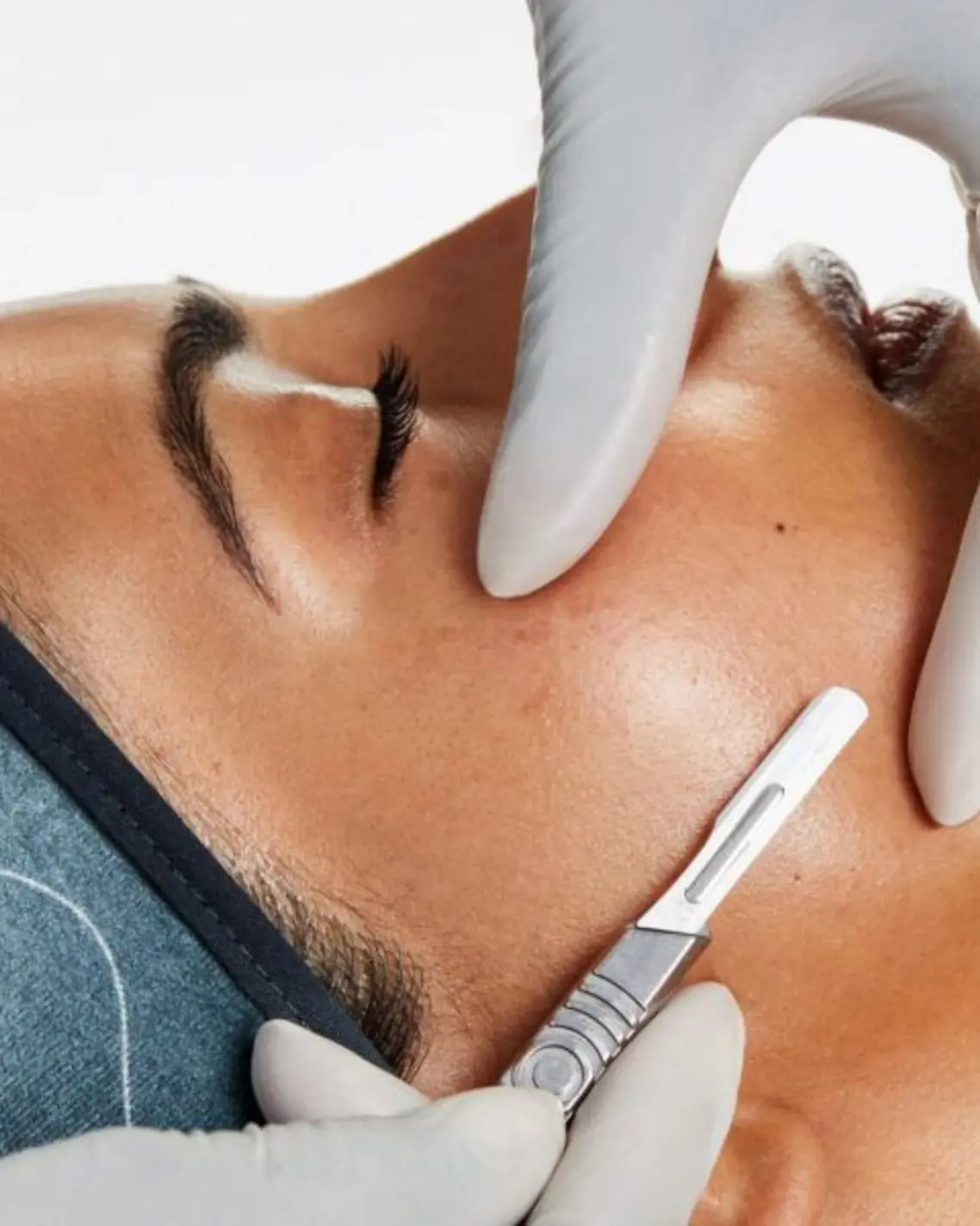 In-office treatments Dermaplaning