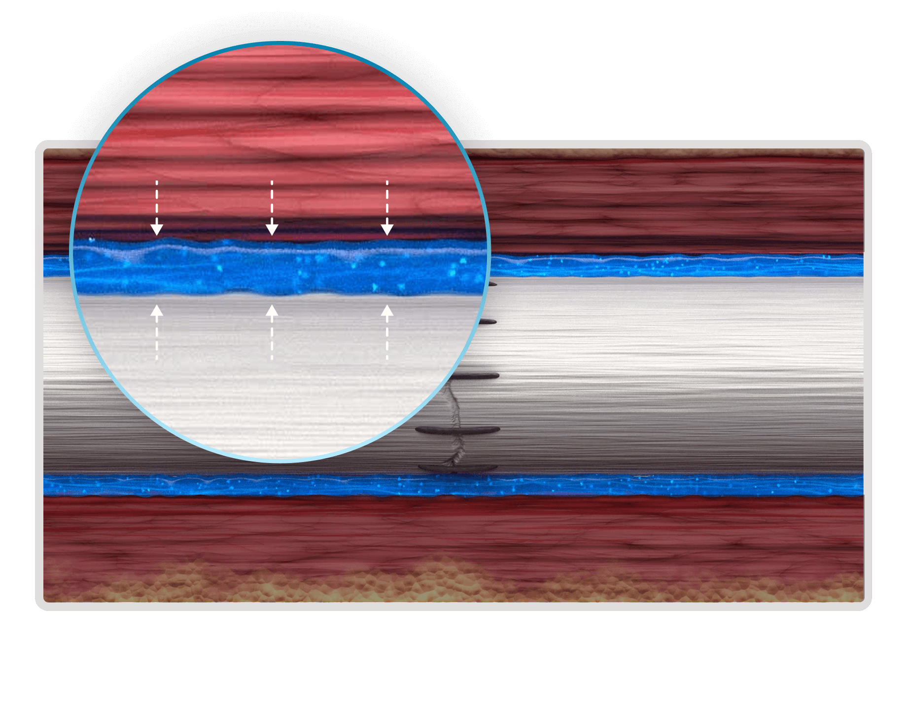 Biomechanical Separation