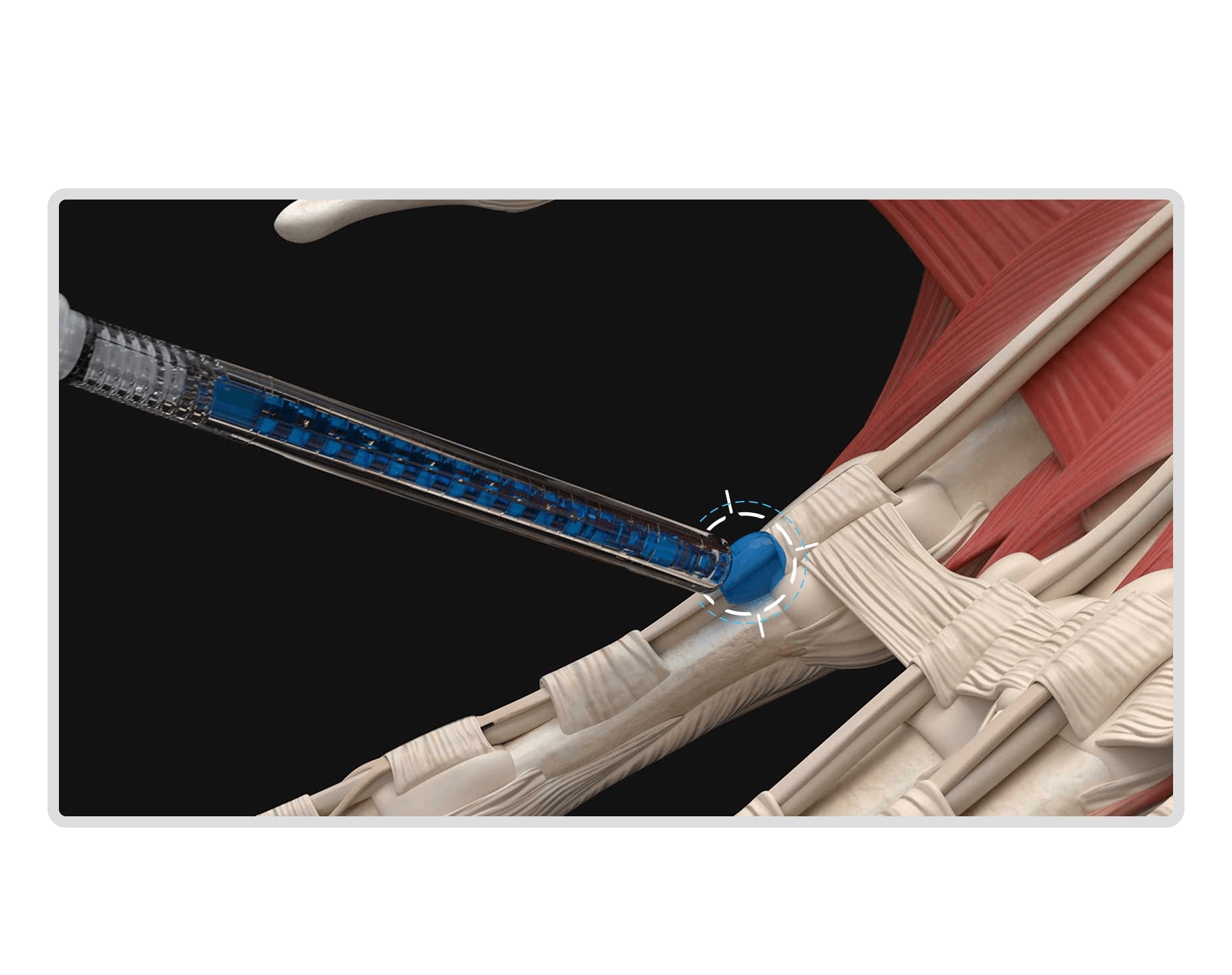 Brilliant Blue Application